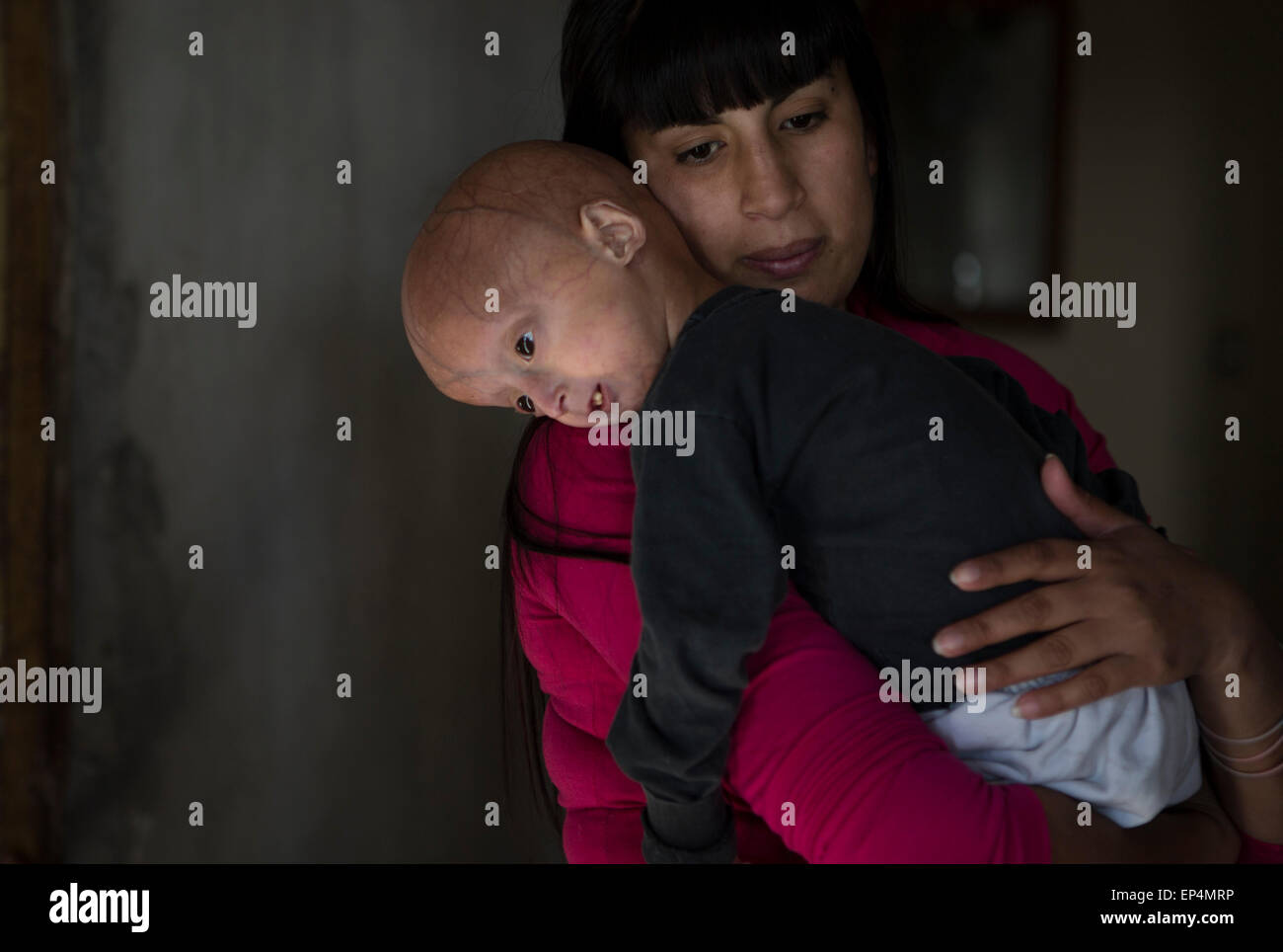 Moreno, en Argentine. 13 mai, 2015. Franco Villavicencio (avant), 4 ans, se repose dans les bras de sa mère, à la maison dans la ville de Moreno, dans la province de Buenos Aires, Argentine, le 13 mai 2015. Progeria (Franco souffre ou vieillissement prématuré). Enfants atteints de cette maladie l'air en bonne santé à la naissance, mais au cours de la première année de vie commencent à démontrer des caractéristiques de la pathologie comme baisse de la croissance, le vieillissement de la peau perte de cheveux, etc. Crédit : Martin Zabala/Xinhua/Alamy Live News Banque D'Images