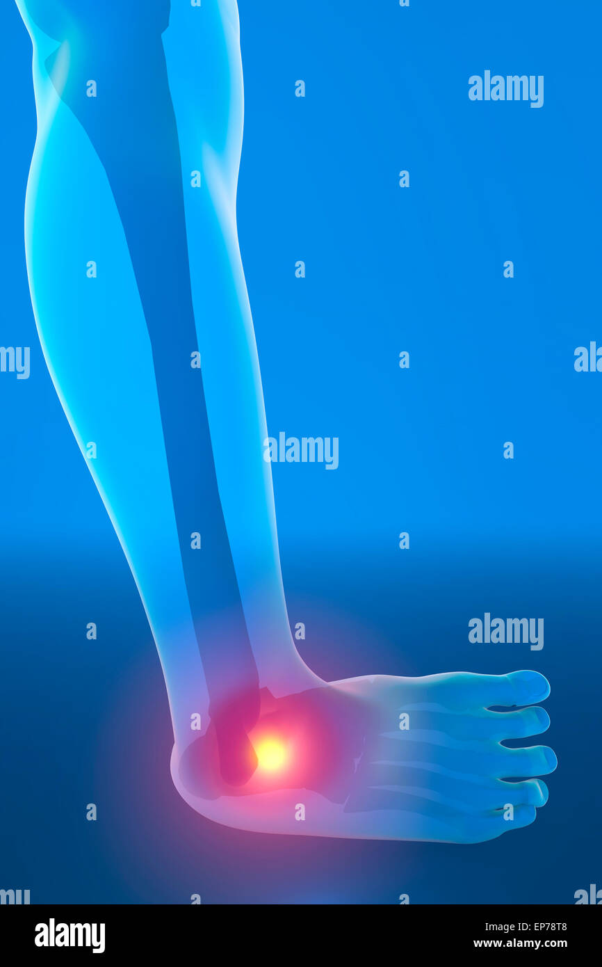 Entorse à la cheville blue x-ray avec zone en surbrillance sur fond bleu Banque D'Images