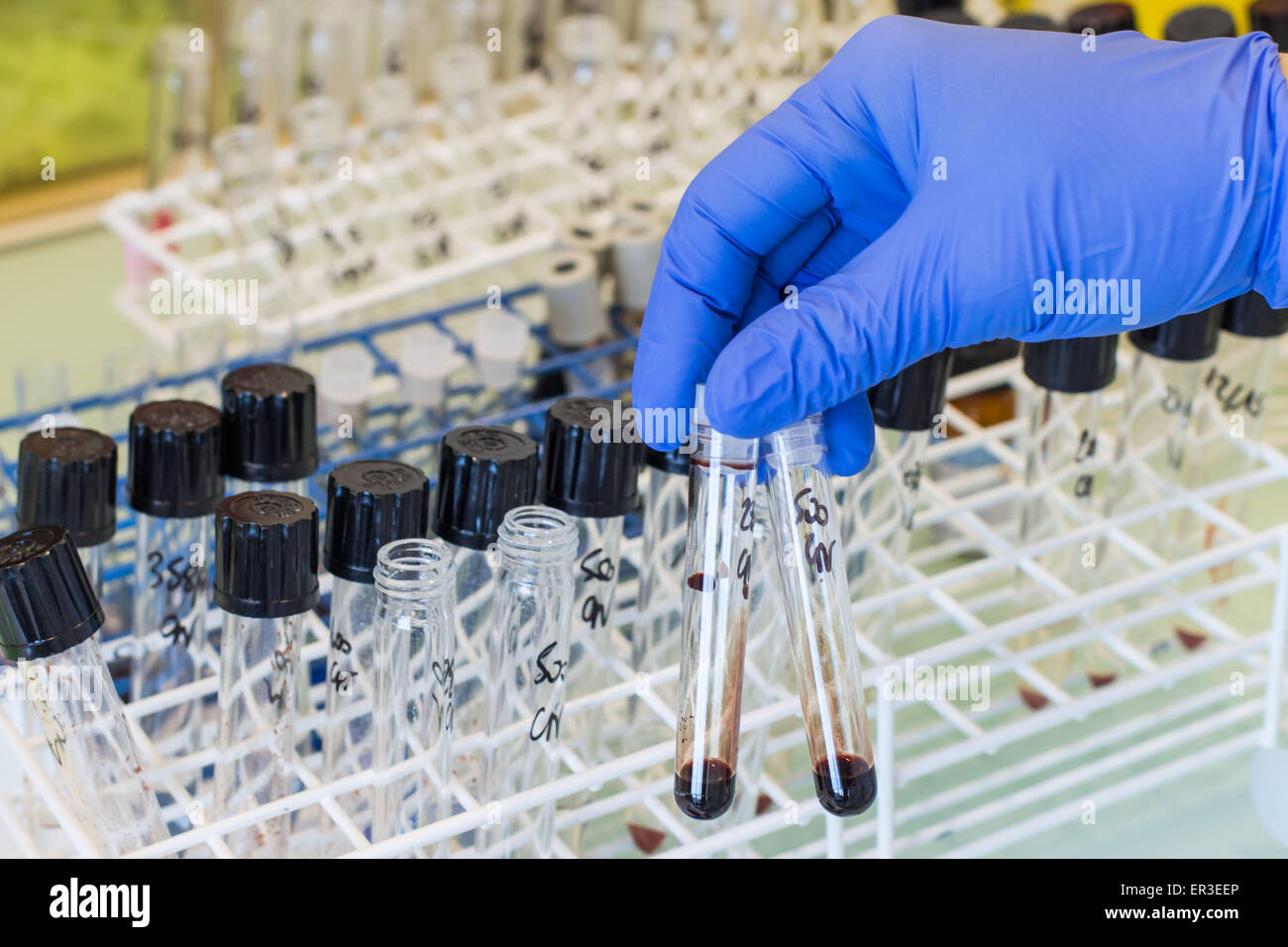 La détermination du cyanure dans le sang. L'analyse médico-légale, Laboratoire de pharmacologie, toxicologie et la pharmacovigilance, biologie et Centre de recherche, en France. Banque D'Images