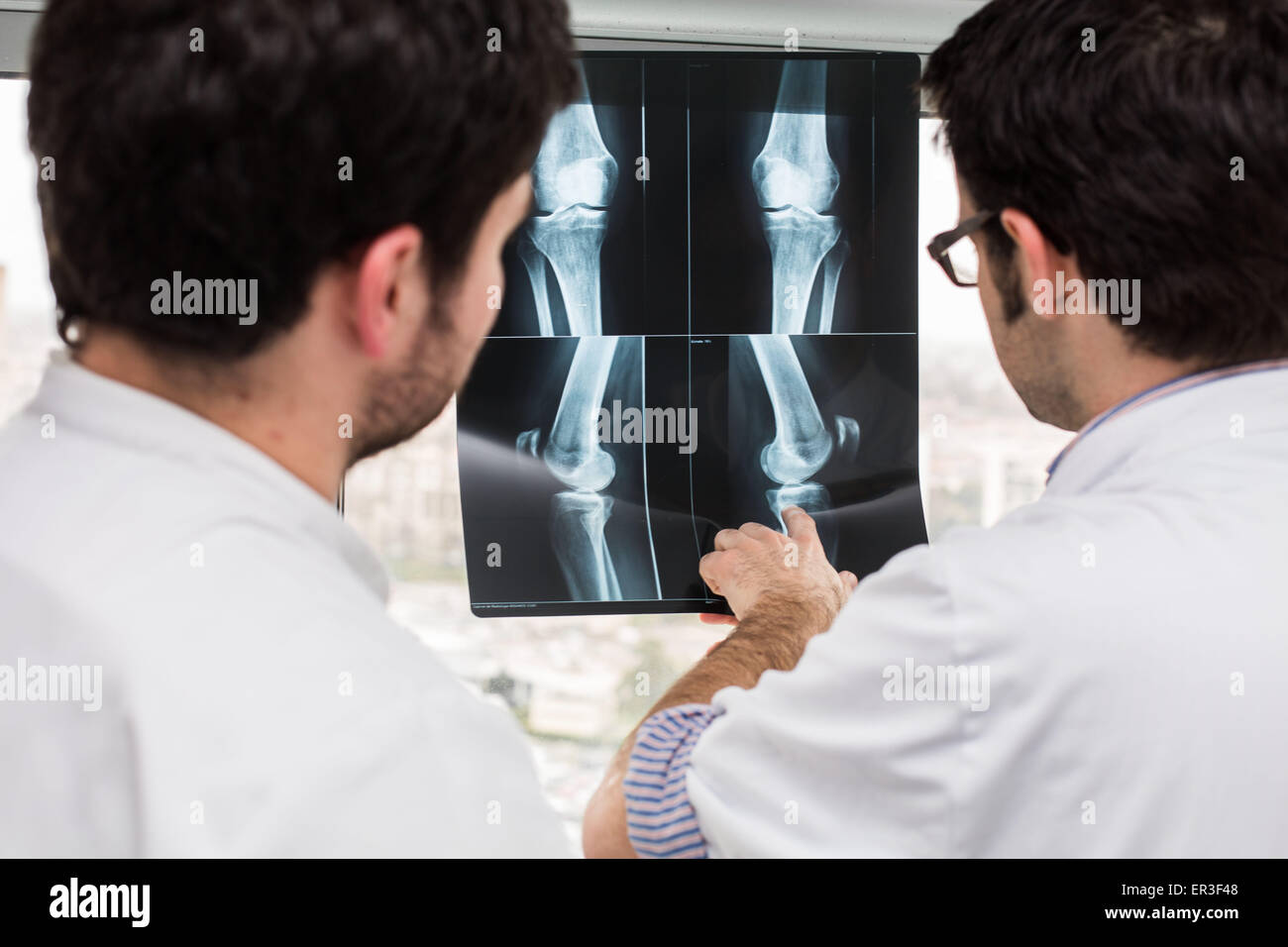 Rhumatologue (droite) et internes l'examen de radiographies du genou d'un patient atteint de polyarthrite rhumatoïde, de l'hôpital de Bordeaux, France. Banque D'Images
