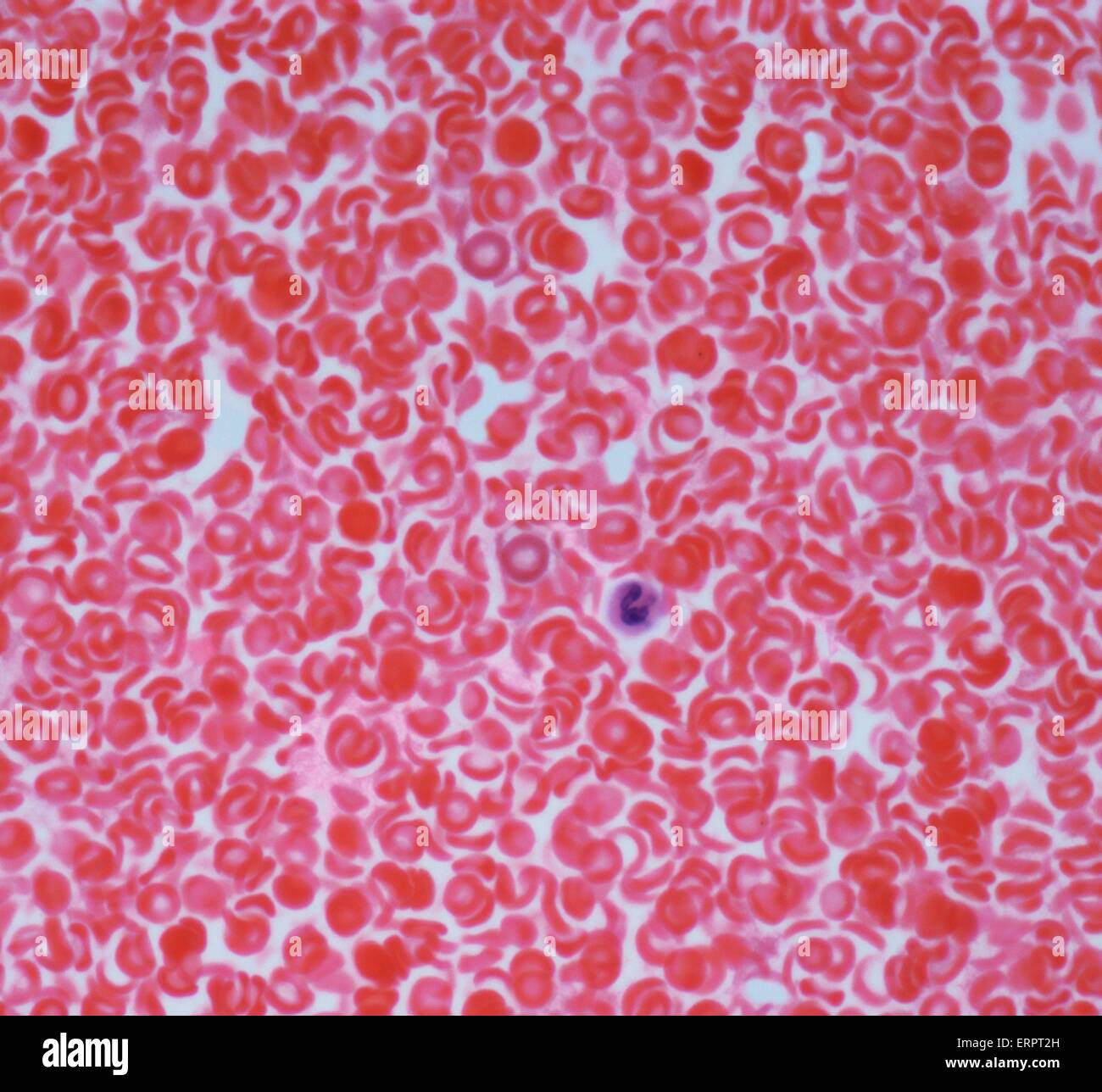 Le sang. La lumière microphotographie des globules rouges (érythrocytes, rouge) dans un vaisseau sanguin. Une seule cellule blanche est visible (centre). Agrandissement : x500 lors de l'impression à 10 centimètres de large. Banque D'Images