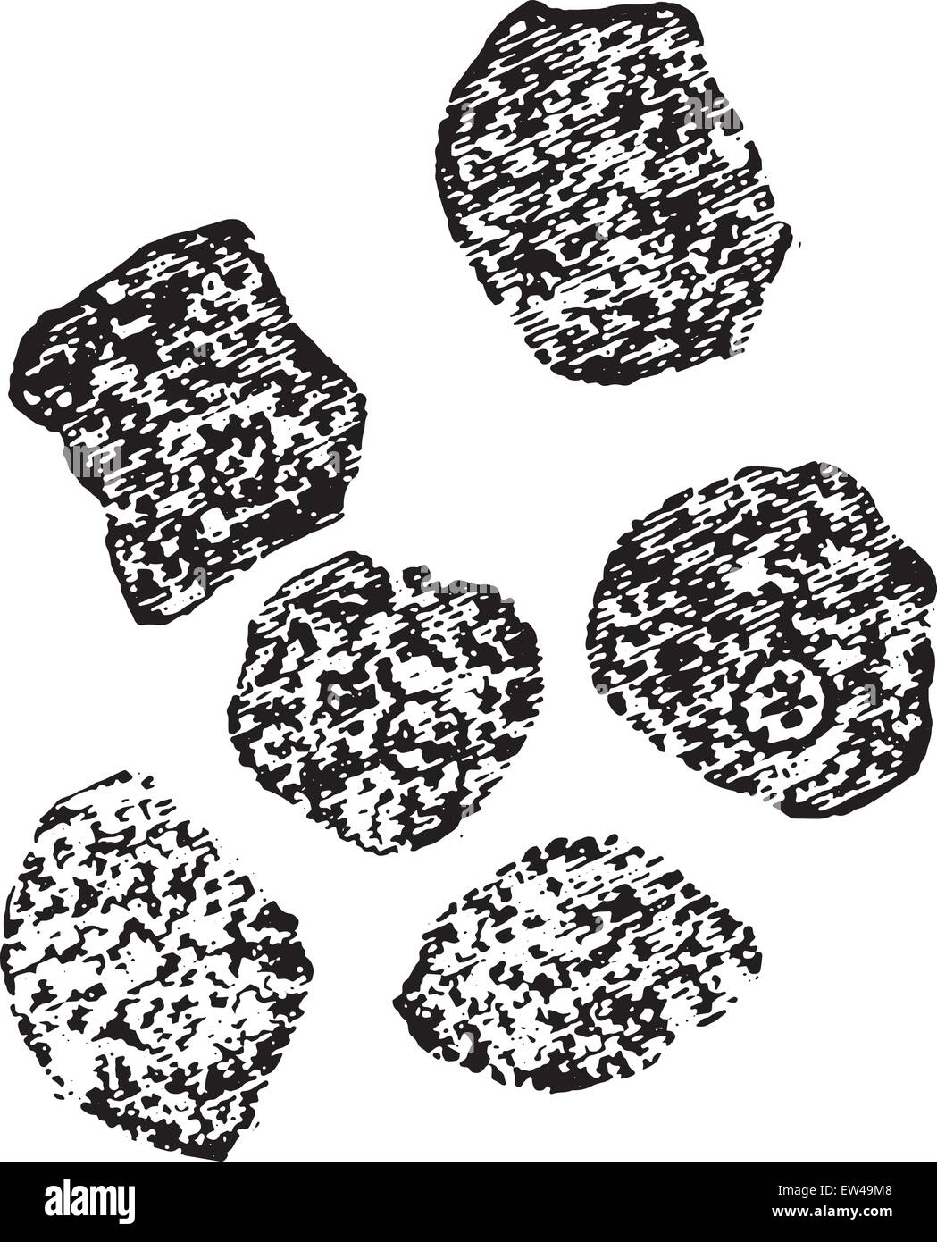 Dégénérescence granulaire(nuageux gonflement) des cellules du foie, vintage engraved illustration. Illustration de Vecteur