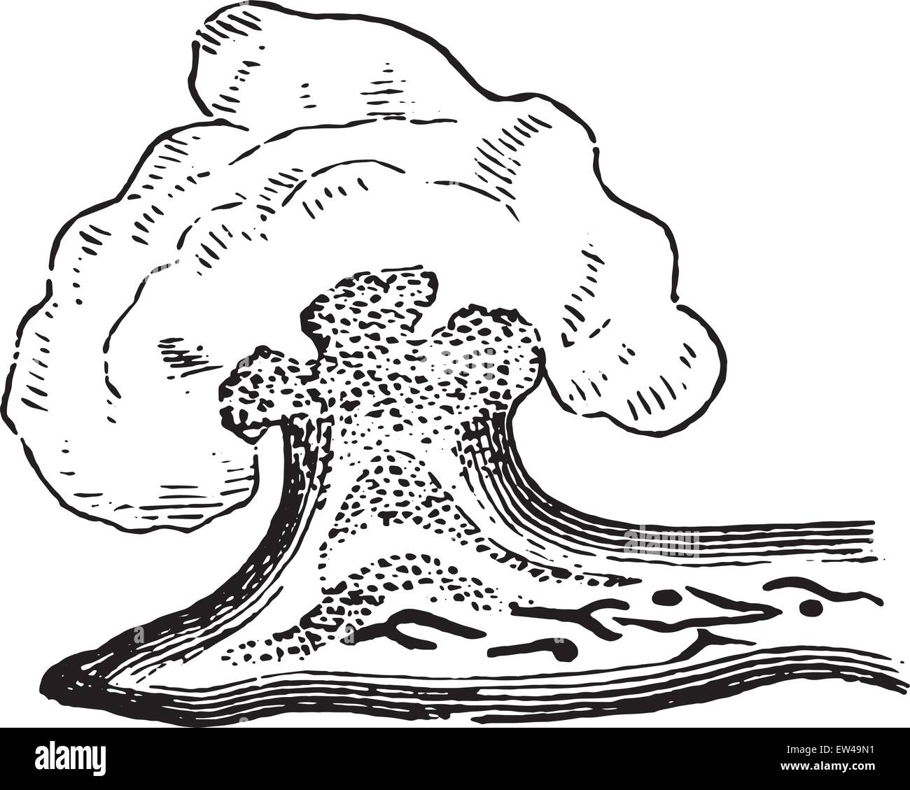 L'endocardite aiguë de la valve mitrale, vintage engraved illustration. Illustration de Vecteur