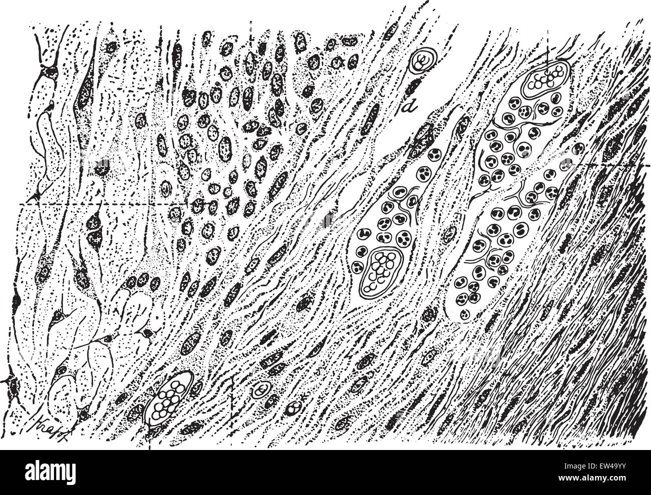 Tissu granuleux, vintage engraved illustration. Illustration de Vecteur