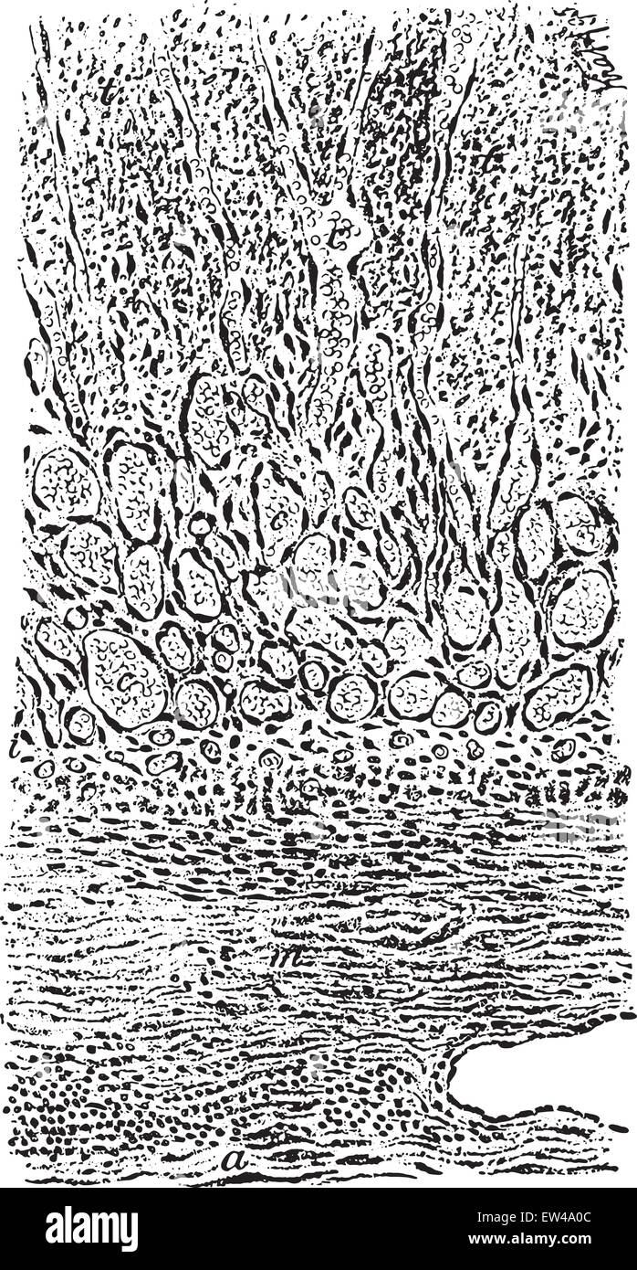 Section à travers une partie d'idées avec ses contenus organiser thrombus, vintage engraved illustration. Illustration de Vecteur