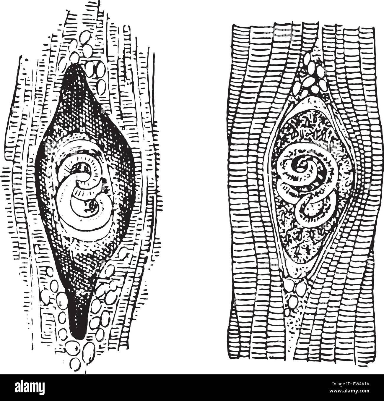 La trichine spiralis, vintage engraved illustration. Illustration de Vecteur