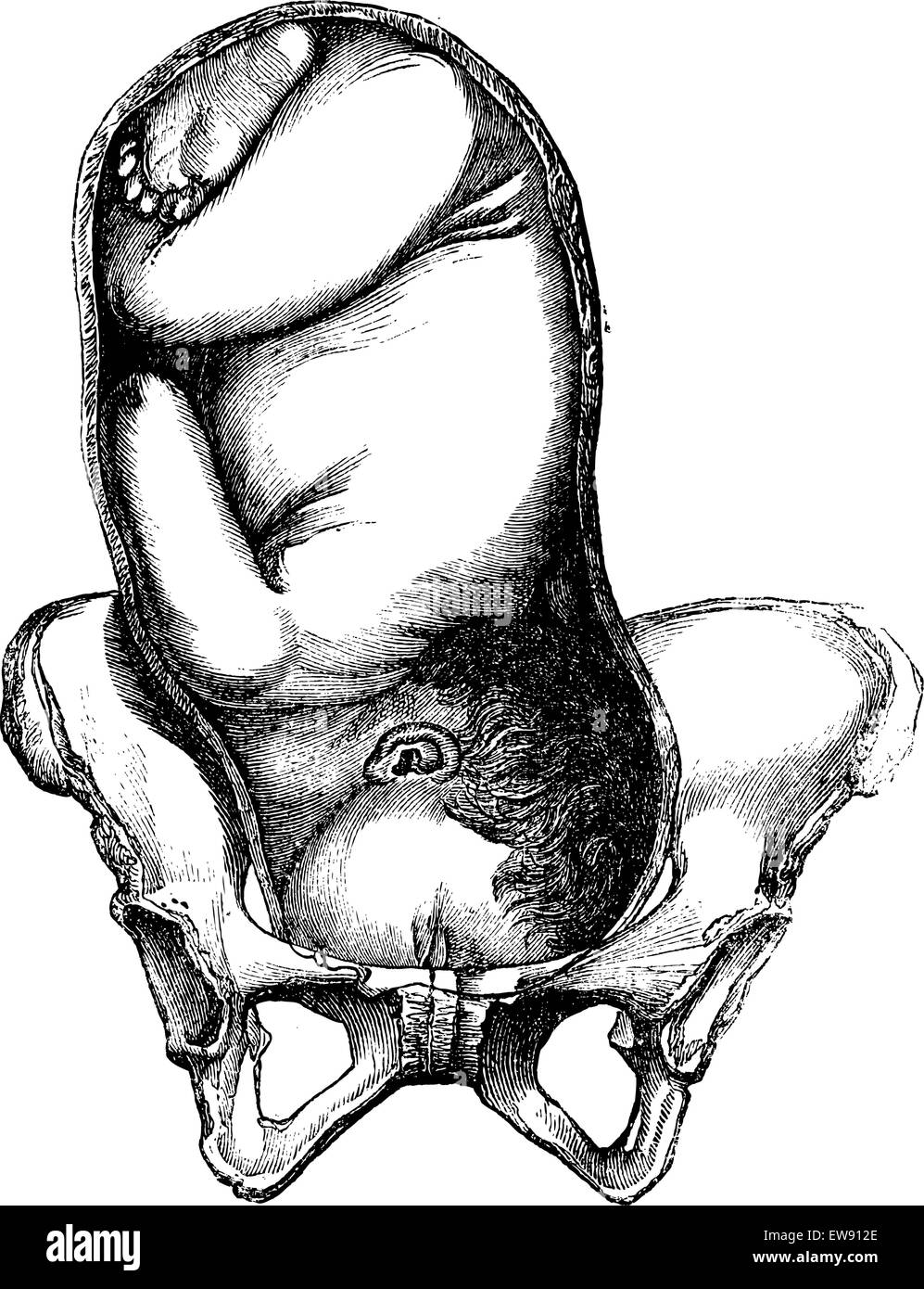 Présentation de la face, du menton vers la droite, vintage engraved illustration. Magasin Pittoresque 1875. Illustration de Vecteur