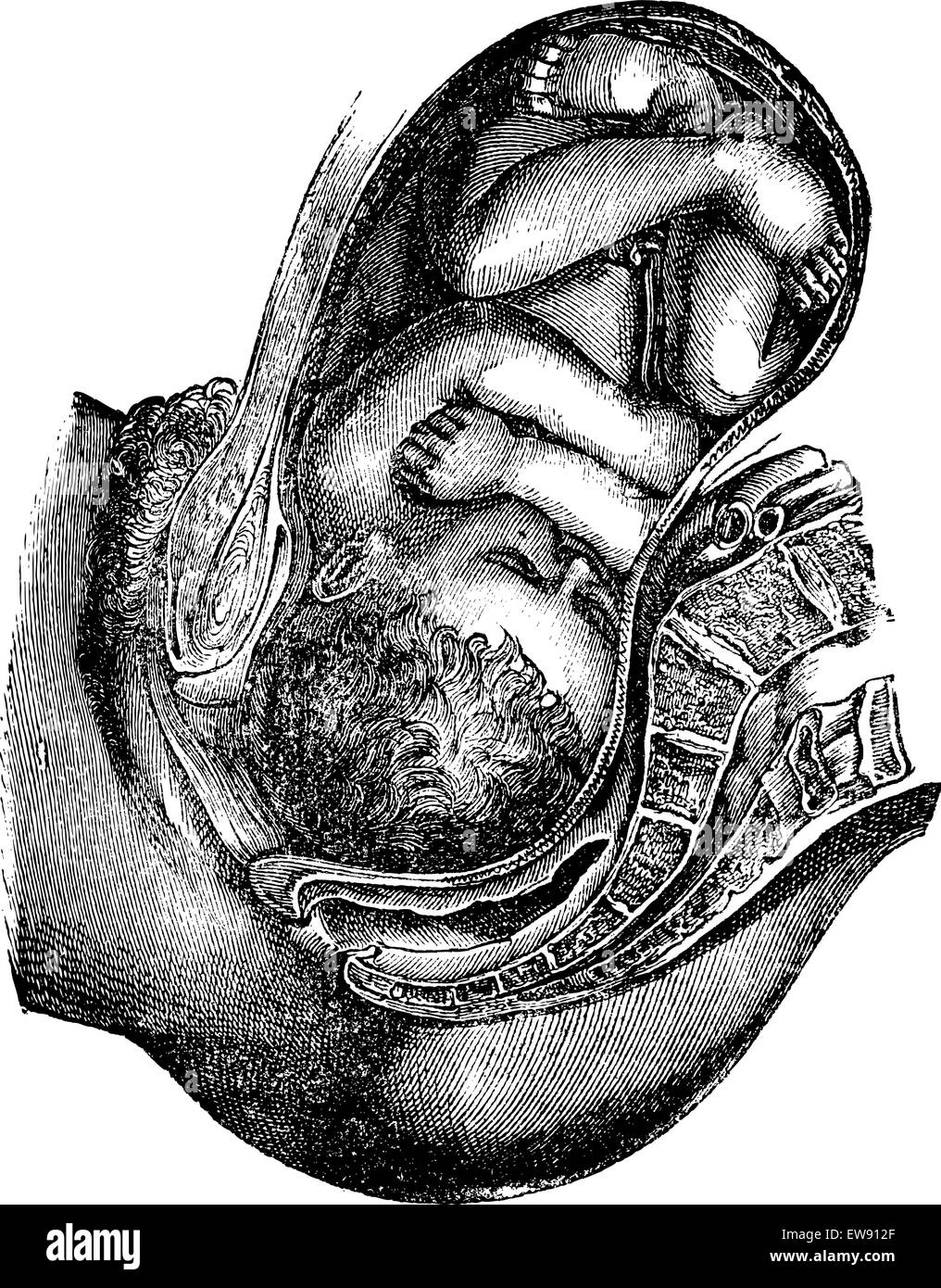 L'engagement et la descente de la tête, vintage engraved illustration. Magasin Pittoresque 1875. Illustration de Vecteur