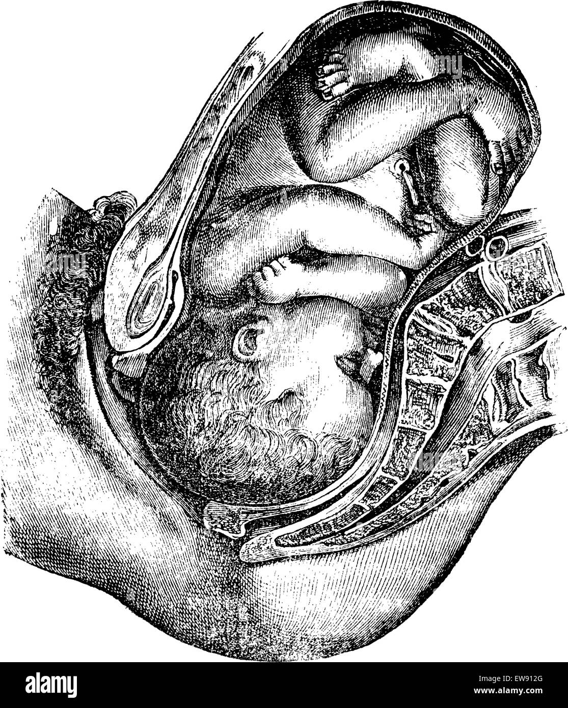 Déjà rempli de rotation, vintage engraved illustration. Magasin Pittoresque 1875. Illustration de Vecteur