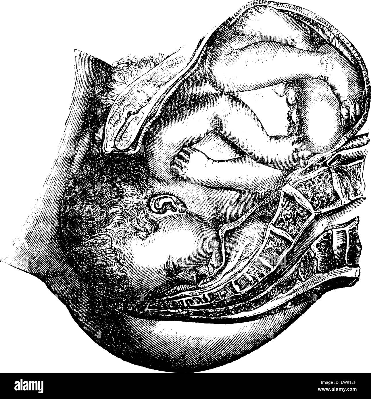 La livraison de la tête, vintage engraved illustration. Magasin Pittoresque 1875. Illustration de Vecteur