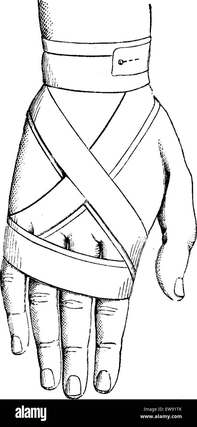 8 bandage de la main, vintage engraved illustration. Dictionnaire de médecine habituelle - Paul Labarthe - 1885. Illustration de Vecteur
