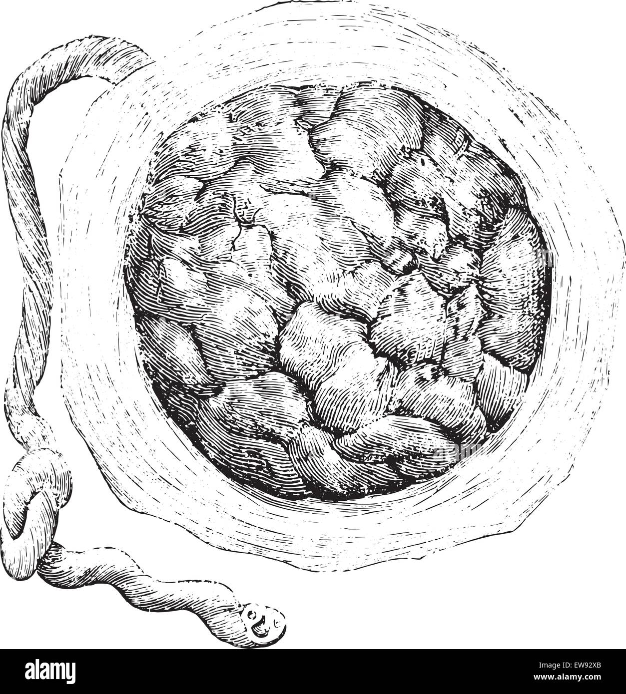 Placenta (externe ou du côté de l'utérus), vintage engraved illustration. Dictionnaire de médecine habituelle par le Dr Labarthe - 1885. Illustration de Vecteur