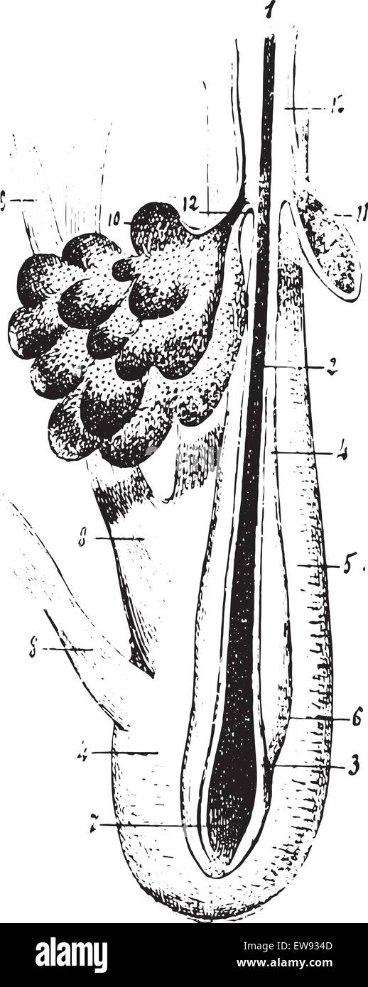 Les follicules pileux avec des glandes sébacées et de fibres musculaires lisses, vintage engraved illustration. Dictionnaire de médecine habituelle par le Dr La Illustration de Vecteur