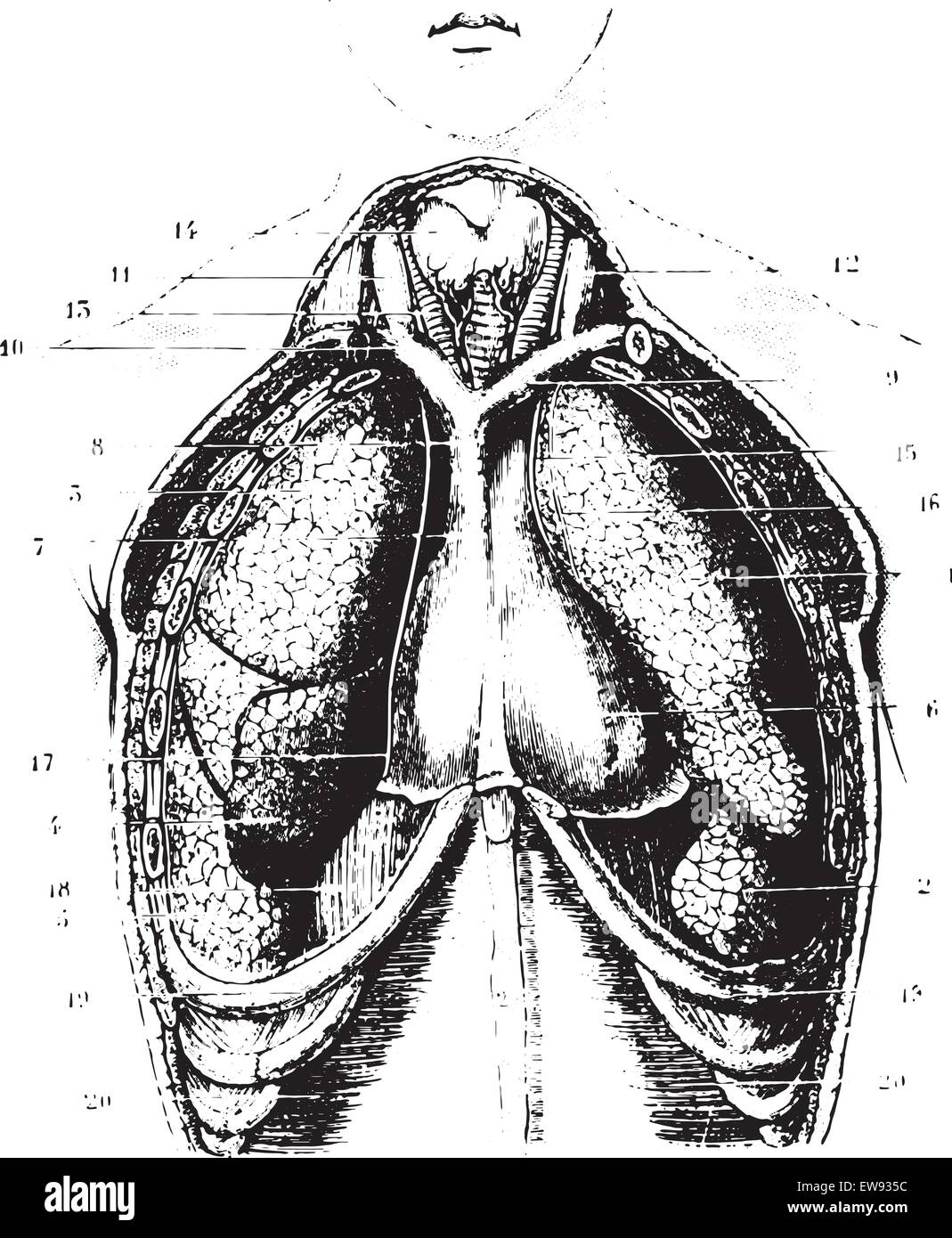 Couper la poitrine d'un spectacle disponible les poumons, la plèvre et le péricarde, vintage engraved illustration. La médecine habituelle diction Illustration de Vecteur