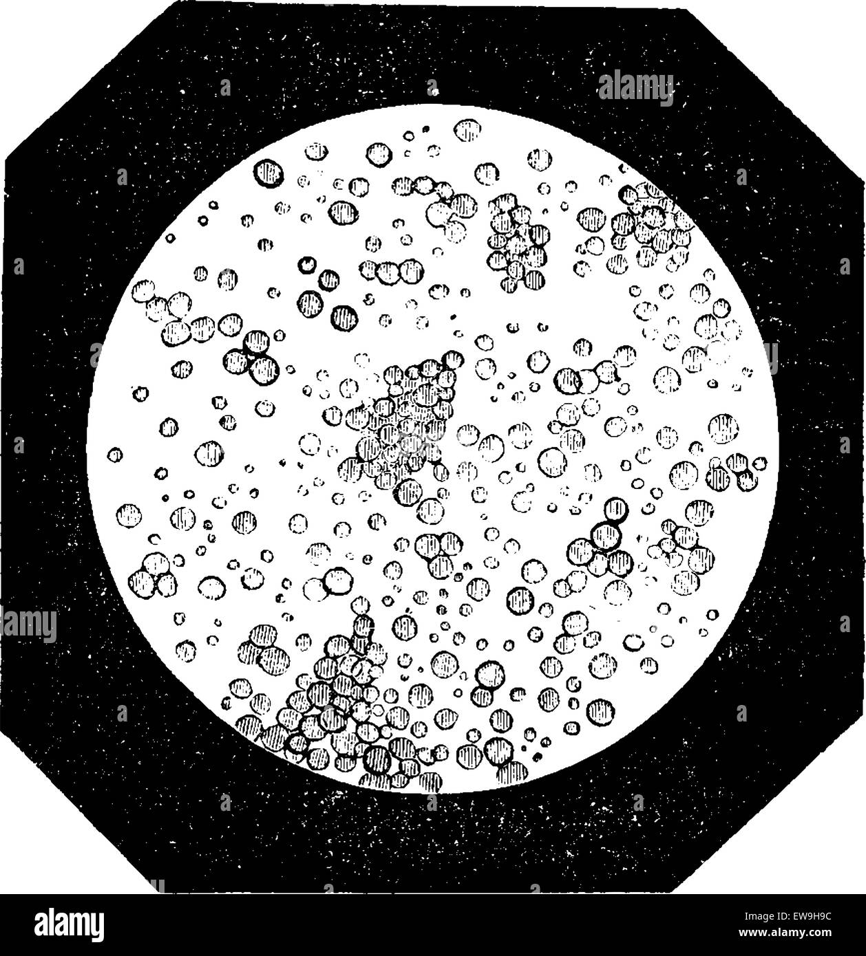 Globules de gras comme vu sous un microscope, vintage engraved illustration. Dictionnaire de médecine habituelle par le Dr Labarthe - 1885 Illustration de Vecteur