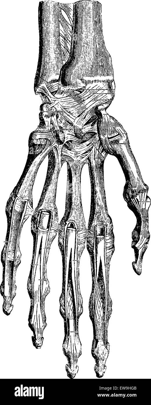 Radiocarpal, mixte, les os carpiens articulation carpométacarpienne et de la main (côté palmiers), vintage engraved illustration. La médecine habituelle Dictio Illustration de Vecteur