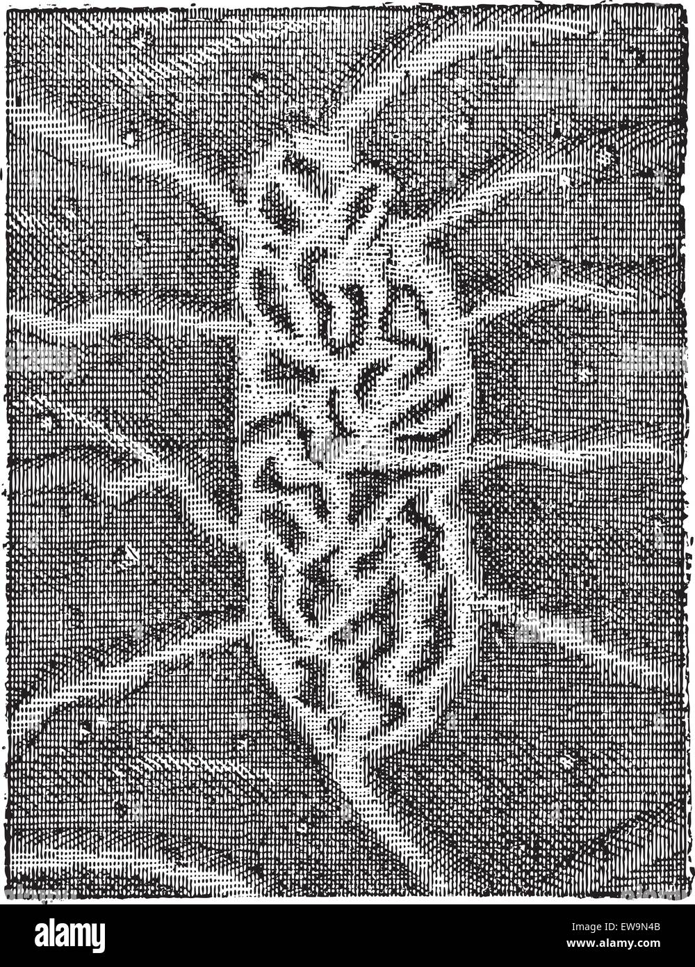 Fig. 6. L'intestin, de Peyer ou nodules lymphoïdes agrégées, vintage engraved illustration. Dictionnaire des mots et des choses Illustration de Vecteur