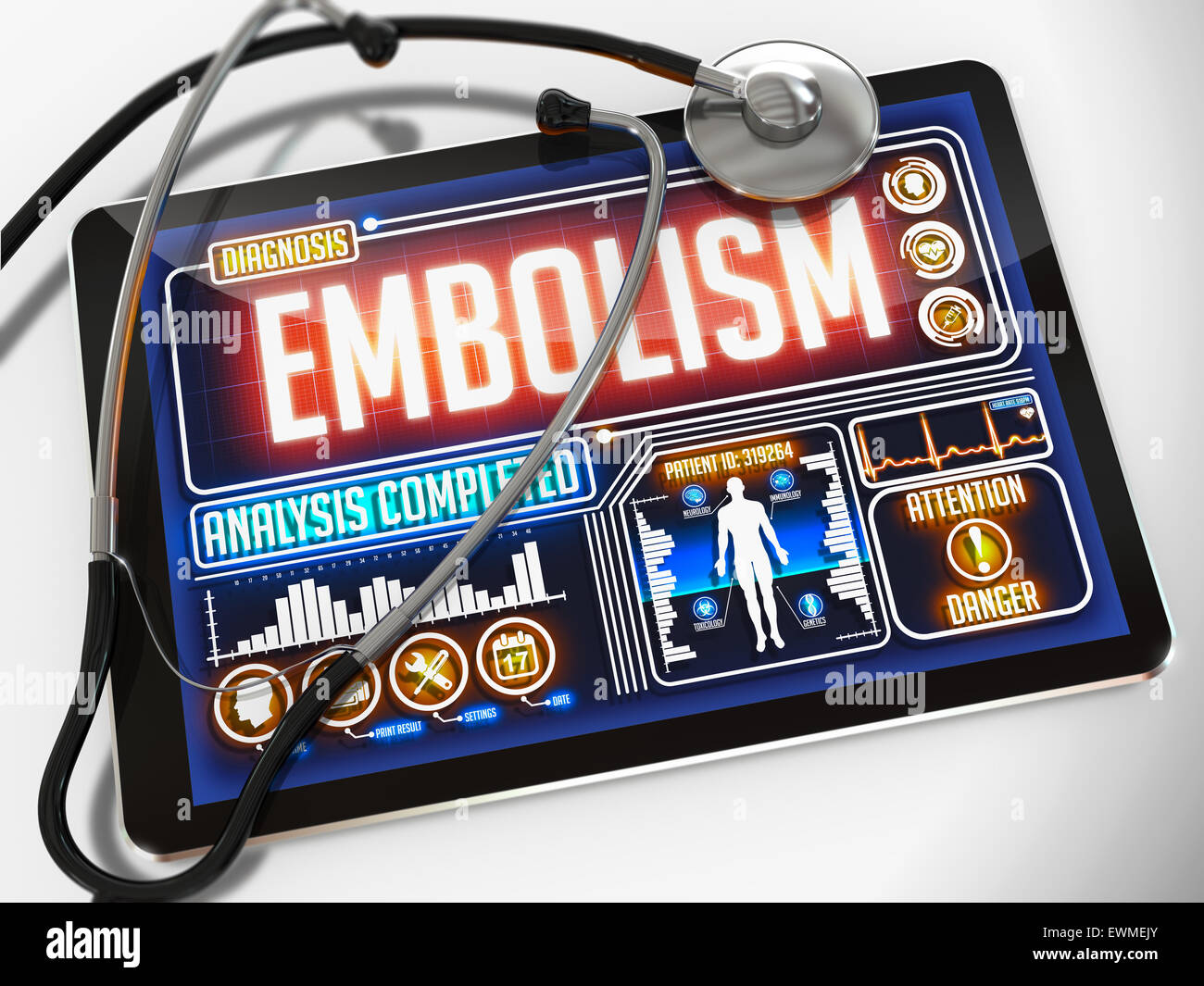 Embolie pulmonaire sur l'affichage de la tablette médicale. Banque D'Images