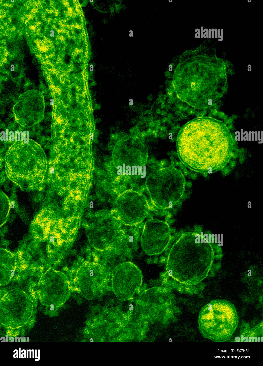 Micrographe colorisée du coronavirus du syndrome respiratoire du Moyen-Orient (MERS-CoV virions) Banque D'Images