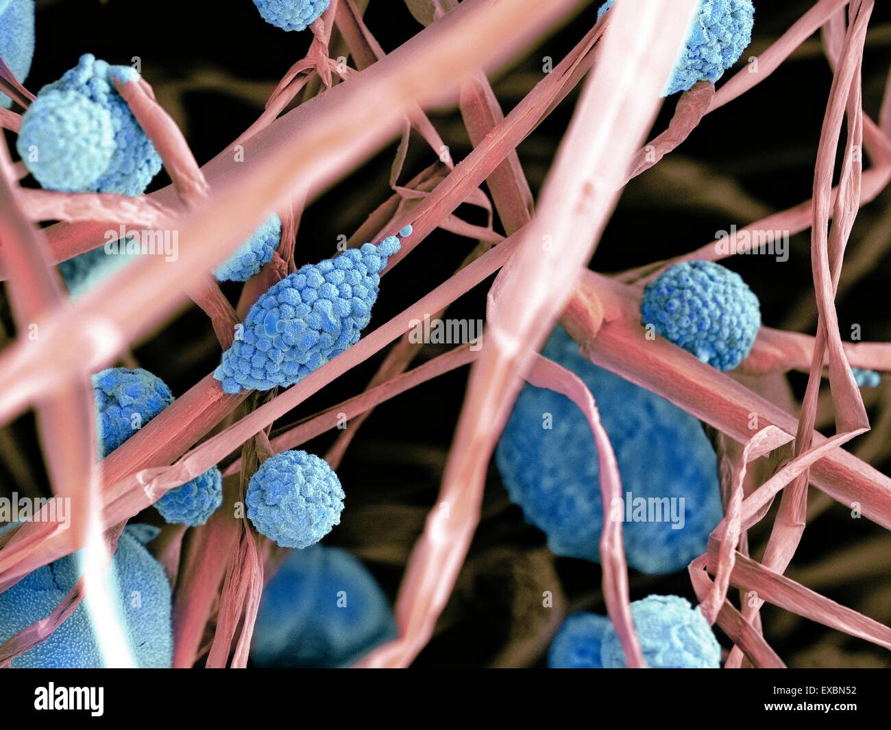 Couleur de l'analyse des électrons Microphotographie (SEM) des cellules fongiques. Les structures rondes sont des sporanges, qui abritent le champignon' Banque D'Images