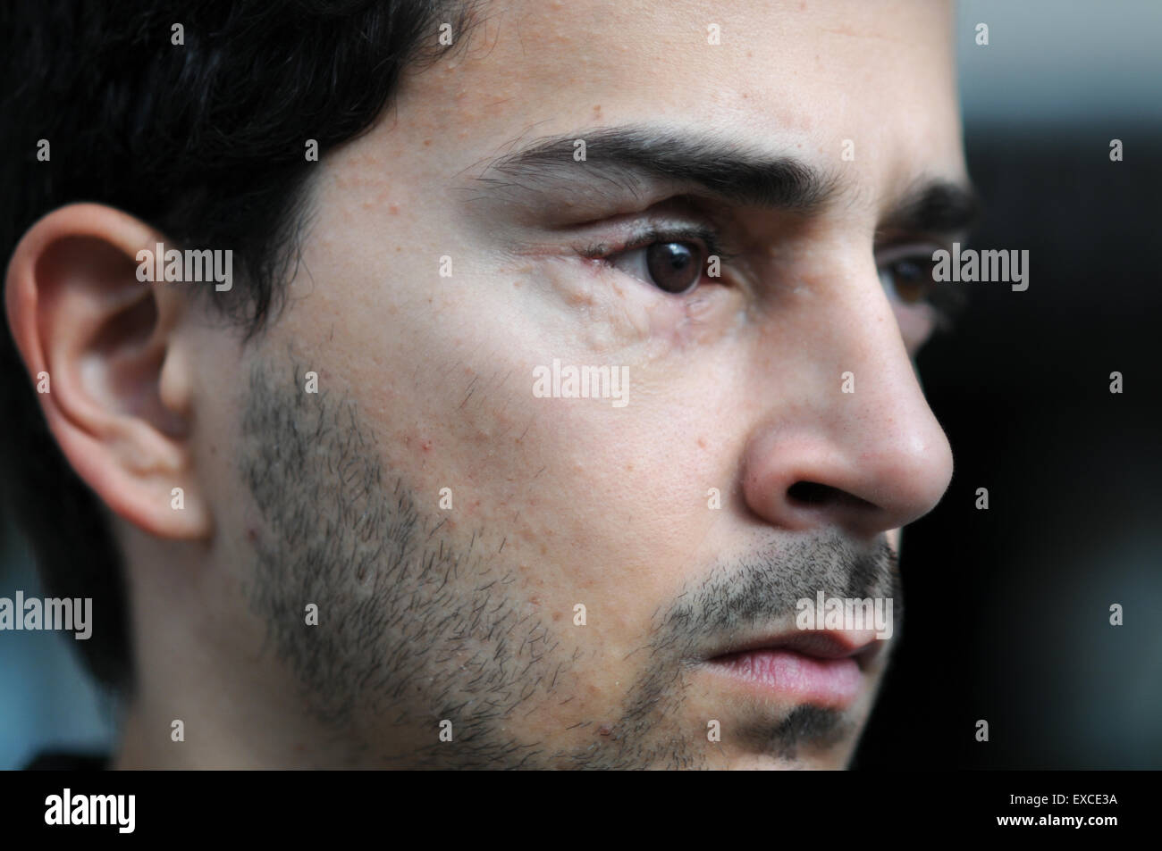 Nicola Tanno, Italien, un de ceux qui sont touchés par l'utilisation de balles en caoutchouc à l'endroit où il a été abattu, le Mas de Francfort situé près de la Plaza Espagne à Barcelone. L'Espagne. Il a perdu un œil. La violence policière. Armes dangereuses. Banque D'Images