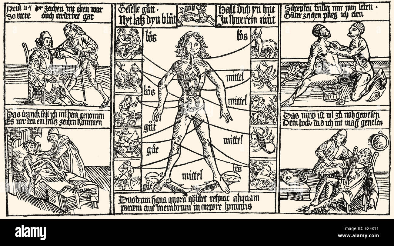 Procédure de traitement de la médecine, saignée, gravure sur bois, 1480, Banque D'Images
