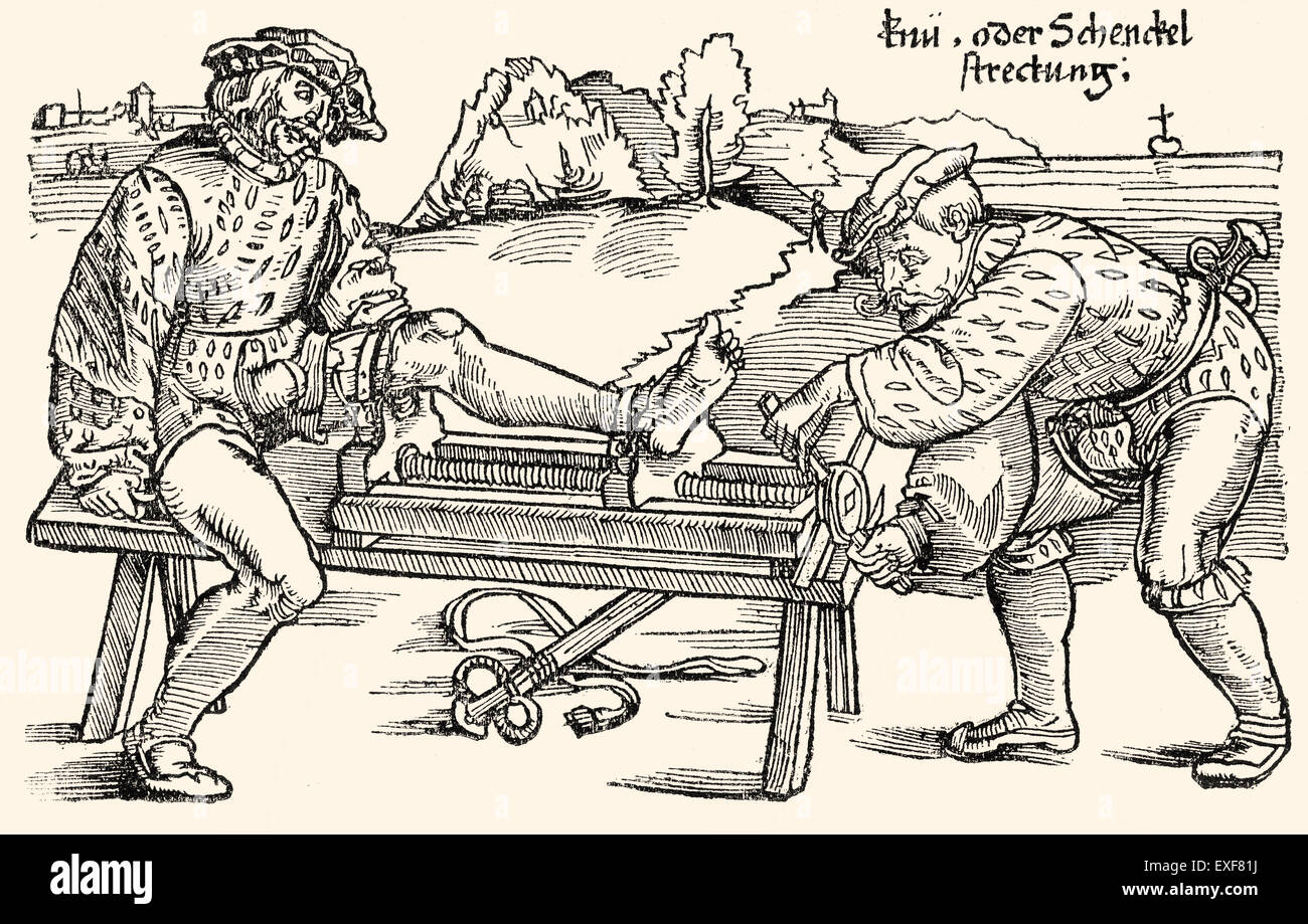 Extension de la jambe s'étend sur un rack, thérapie orthopédique, gravure sur bois de 'Feldtbuch der Wundartzney" par Hans von Gersdorff, 1528 Banque D'Images