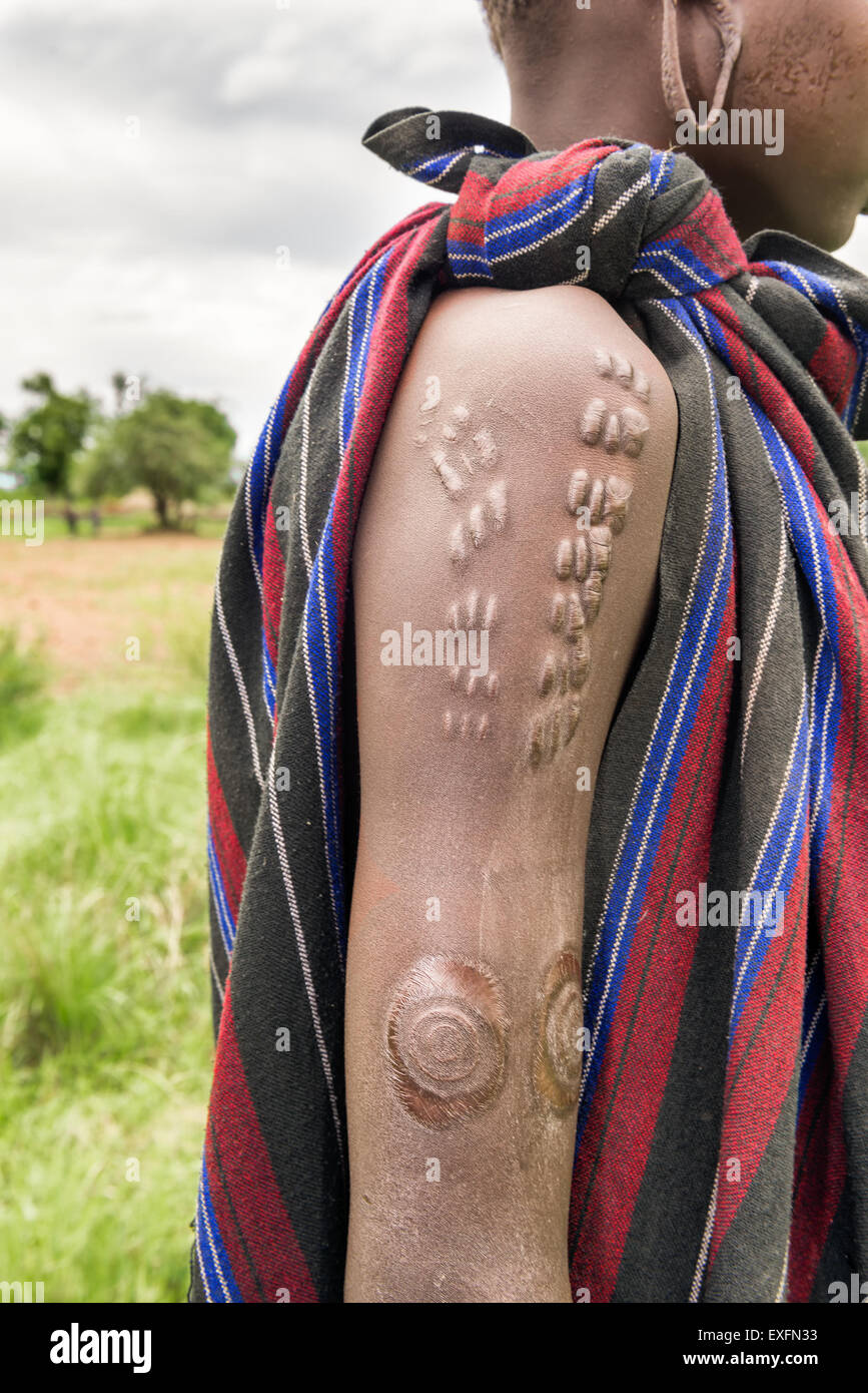 La scarification traditionnelle typique de la tribu Mursi en Ethiopie Banque D'Images