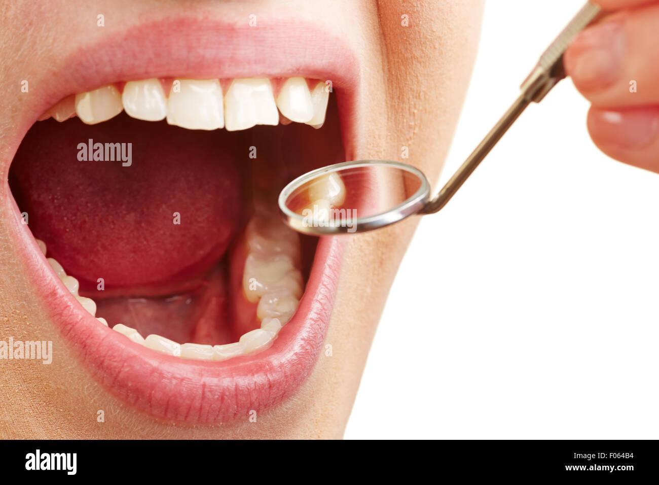 Femme avec la bouche ouverte au dentiste avec miroir Photo Stock - Alamy