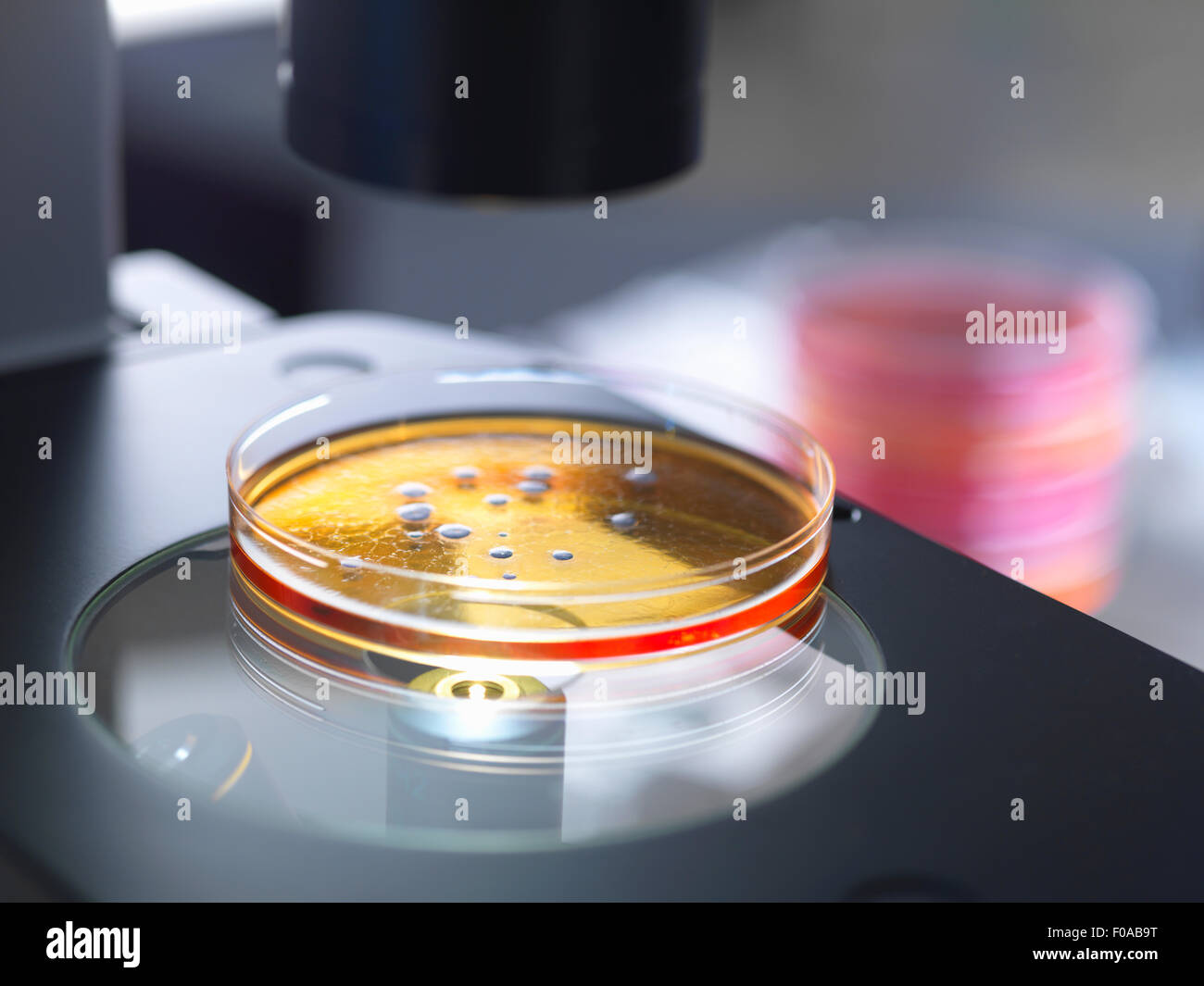Boîte de Pétri contenant une culture bactérienne d'être examiné avec un microscope optique inversé dans les laboratoires de microbiologie Banque D'Images