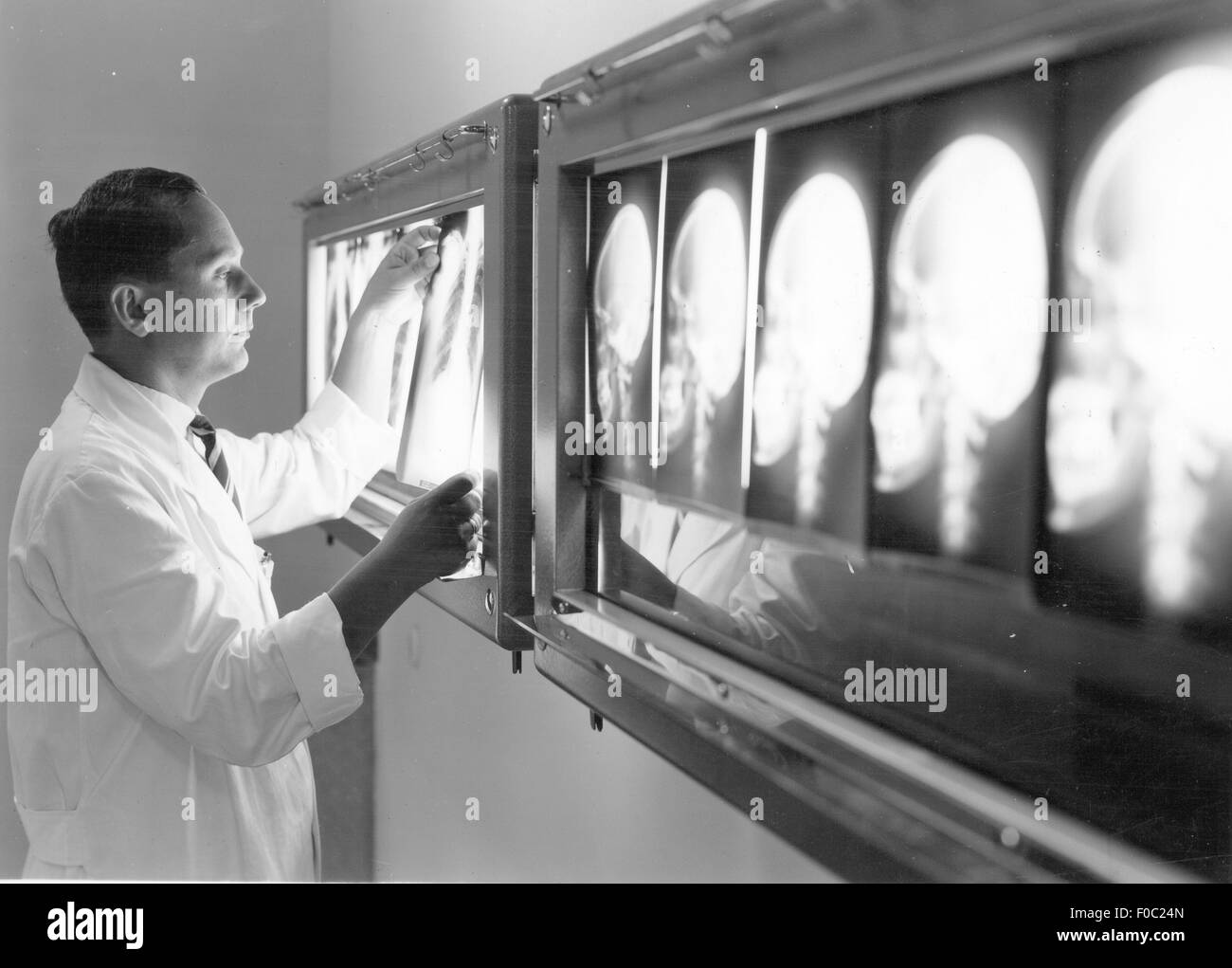 Médecine, irradiation / rayons X / mesure, médecin regardant les radiographies, années 1960, droits additionnels-Clearences-non disponible Banque D'Images