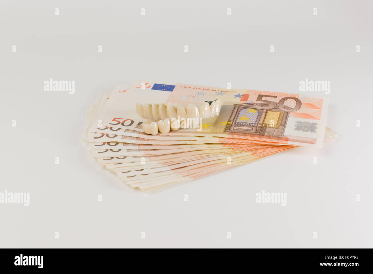 L'augmentation du coût des prothèses au dentiste pour dépenser beaucoup d'argent Banque D'Images