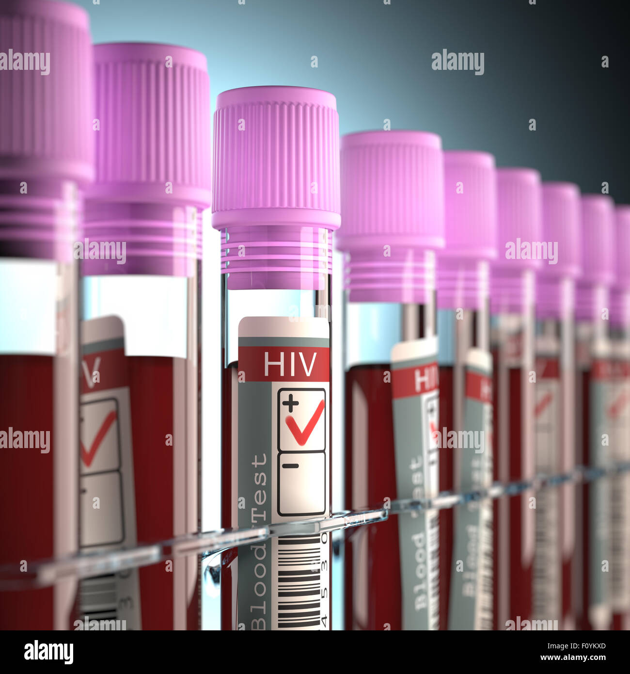 Concept Image avec le résultat de test du VIH. Banque D'Images