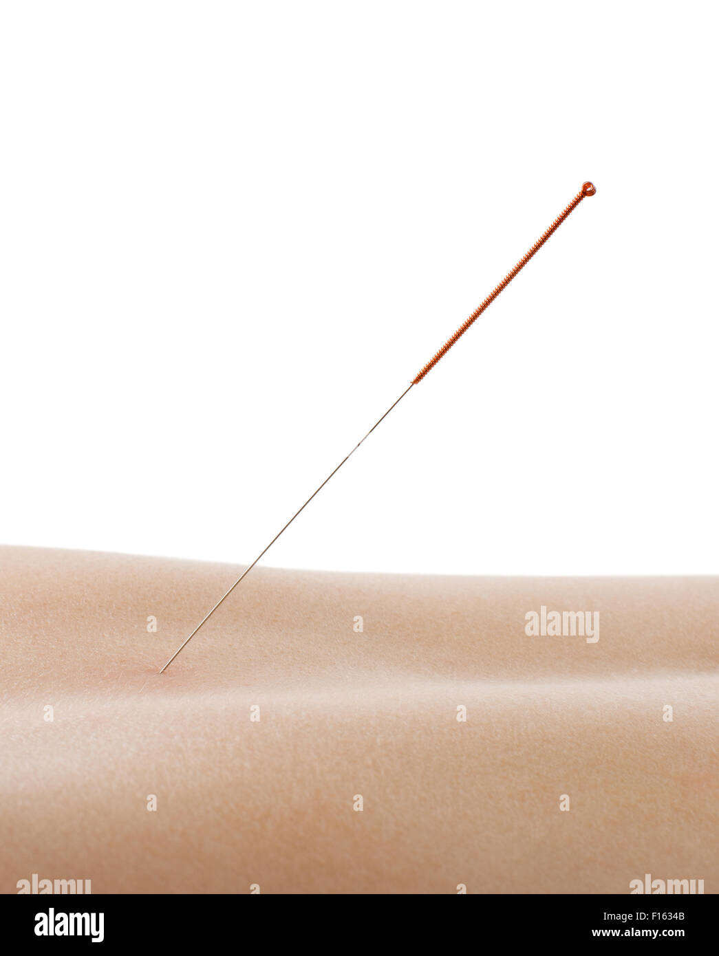 L'acupuncture, l'aiguille dans le dos, la peau, isolé sur fond blanc Banque D'Images