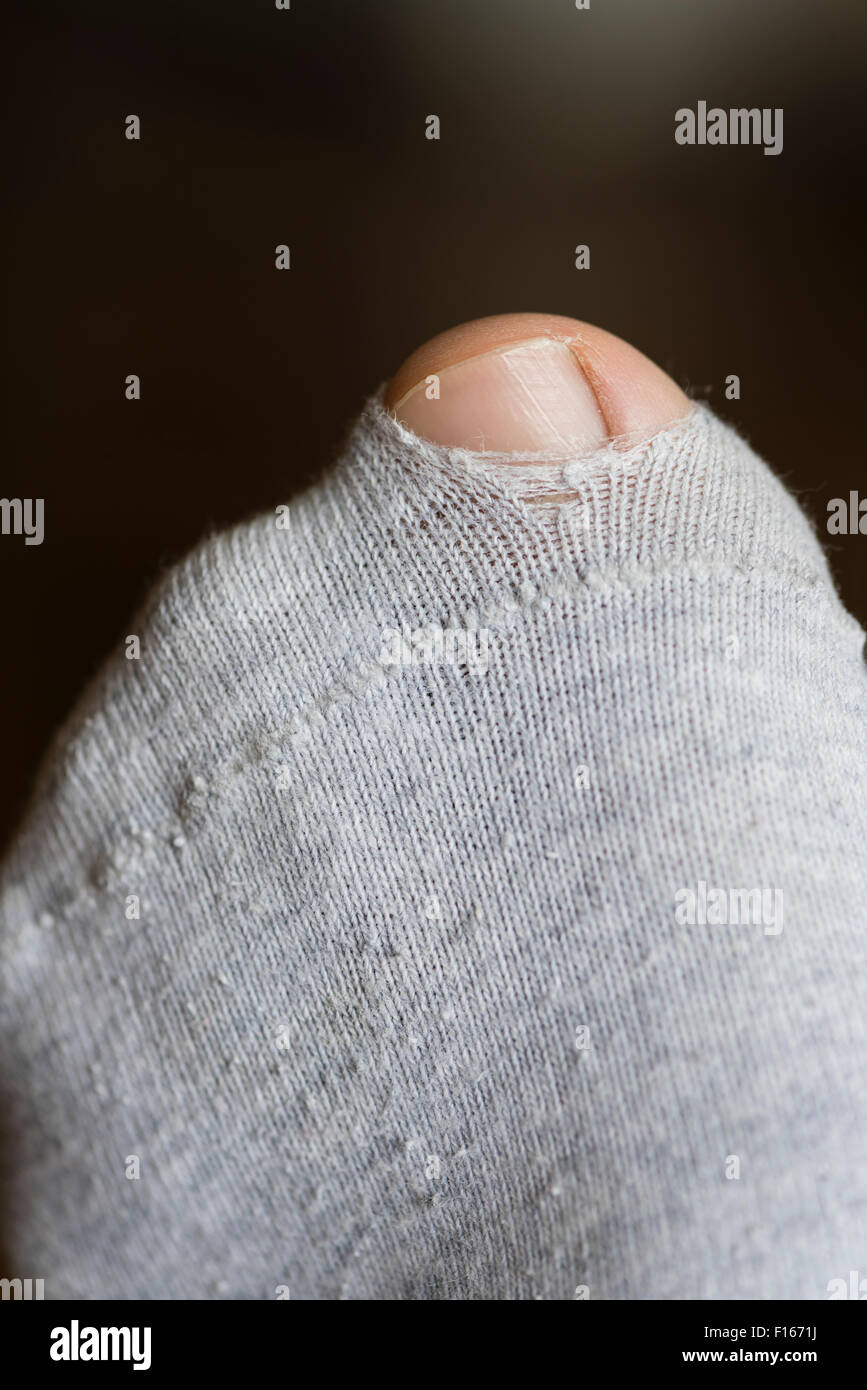 Gros orteil du pied gauche venant d'un petit trou dans une chaussette déchirée faits de coton gris Banque D'Images