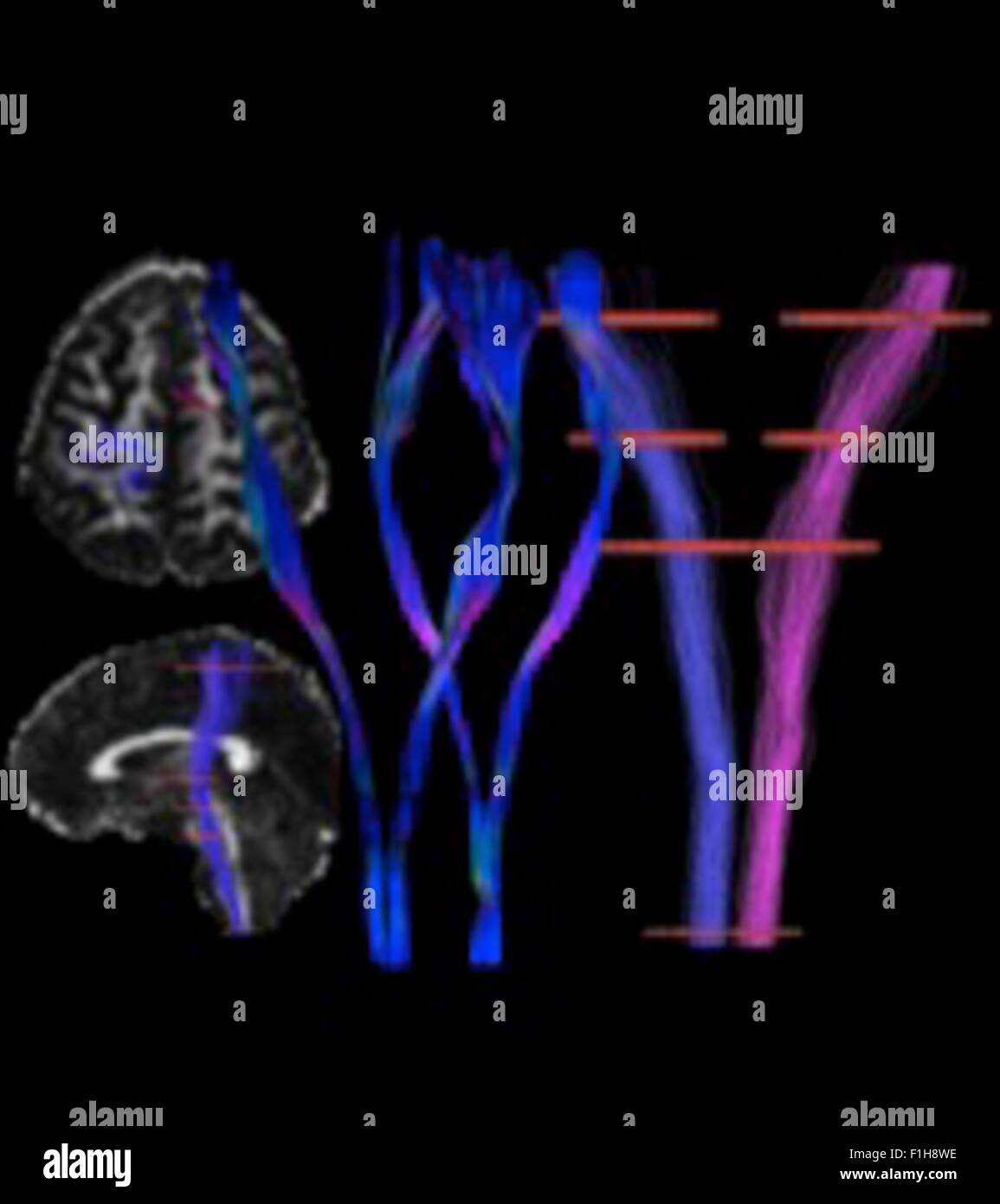 La corticale de la moelle intestinal, l'appareil moteur, gauche et droit, à un sujet humain Banque D'Images