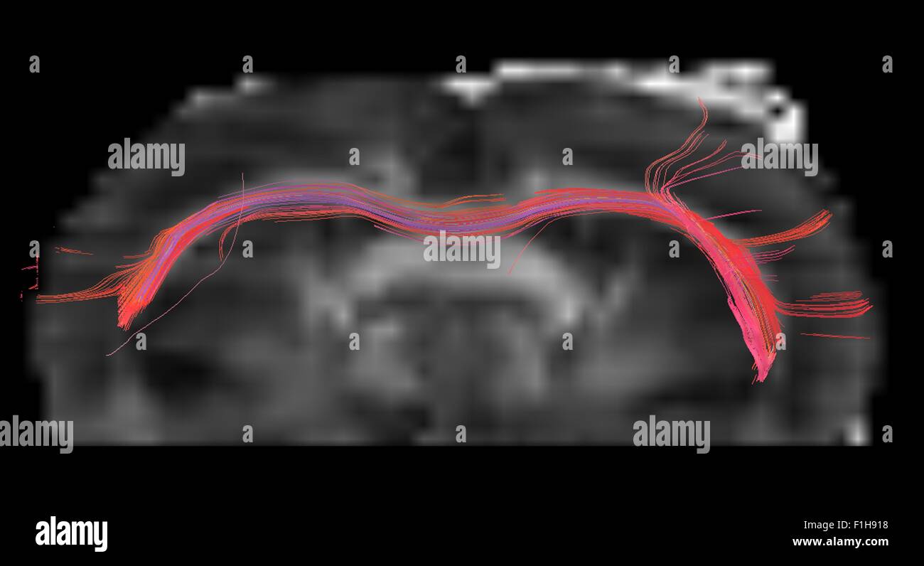 Le corps calleux de cerveau de rat, dans un plan axial Banque D'Images