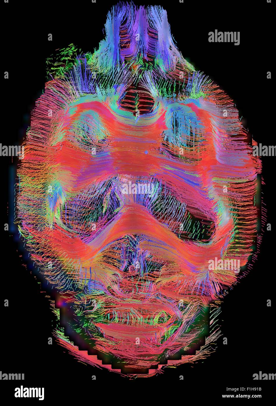 Vue coronale du cerveau du rat la connectivité. Vue d'en haut. Reconstruit les images à 300 microns isotrope Banque D'Images