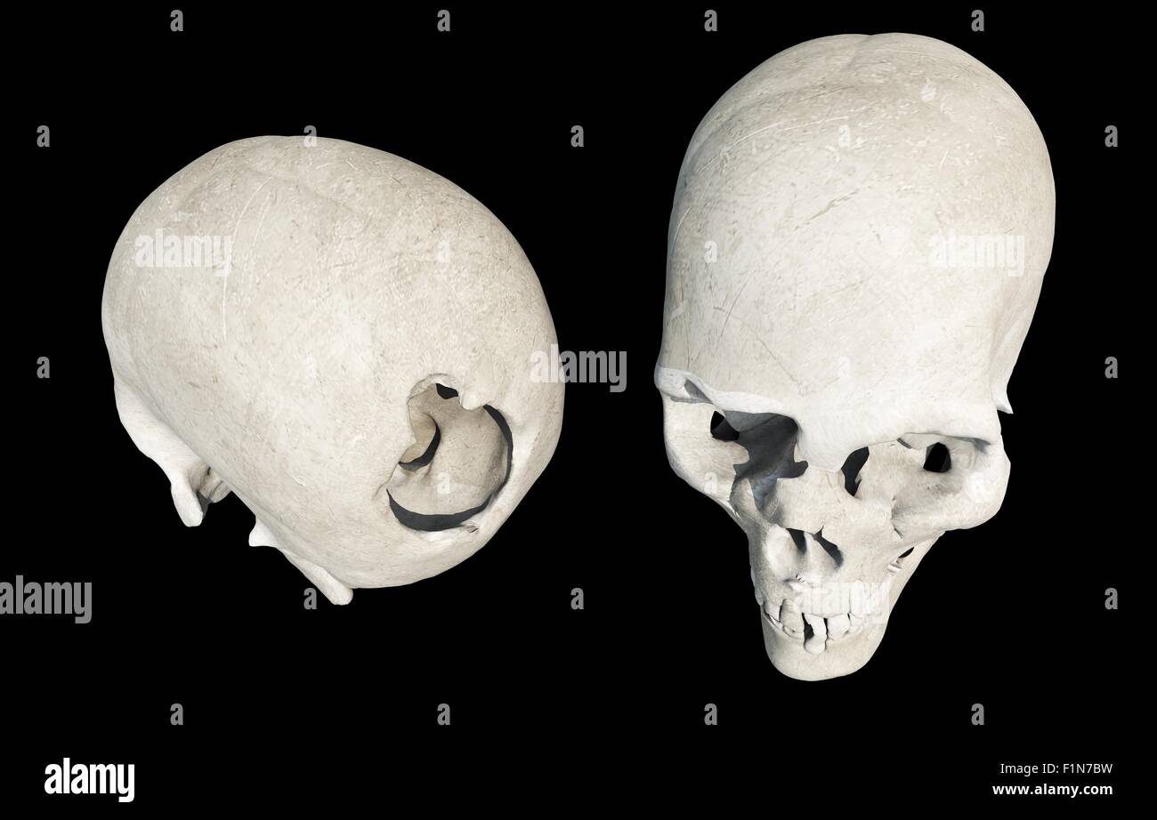 Crâne endommagé isolé sur noir. Illustration de crânes. Banque D'Images