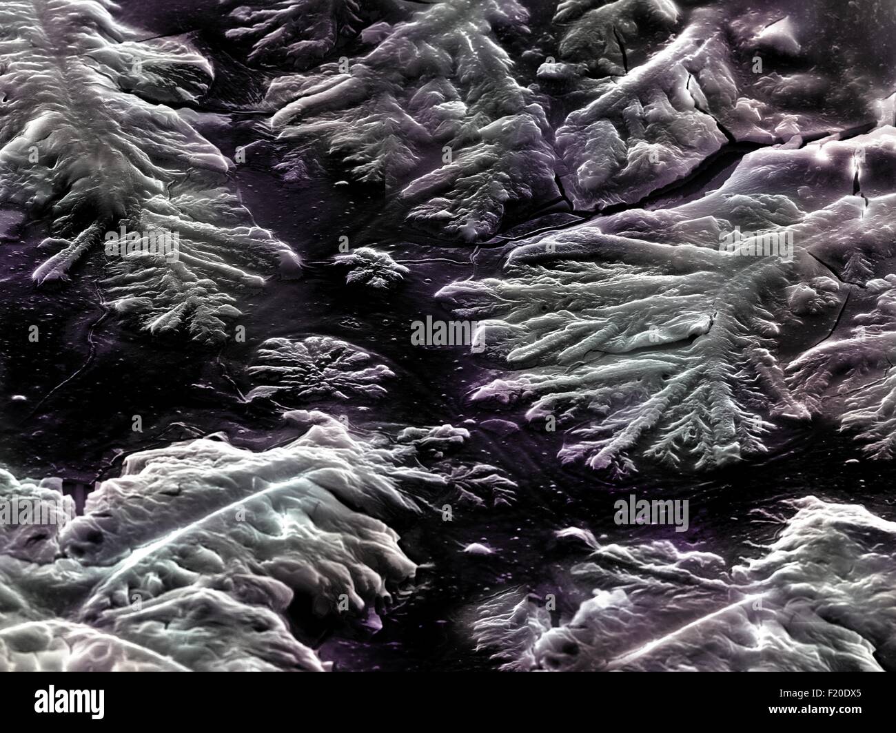 Les droits de l'tristesse teardrop réalisée en microscopie électronique Banque D'Images