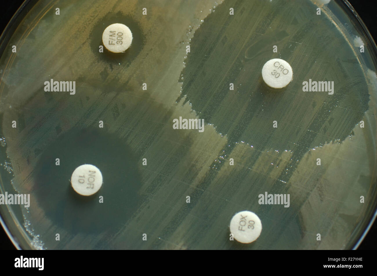 Boîte de Pétri avec de la sensibilité aux antibiotiques des zones d'inhibition pour disques montrant des colonies bactériennes Banque D'Images