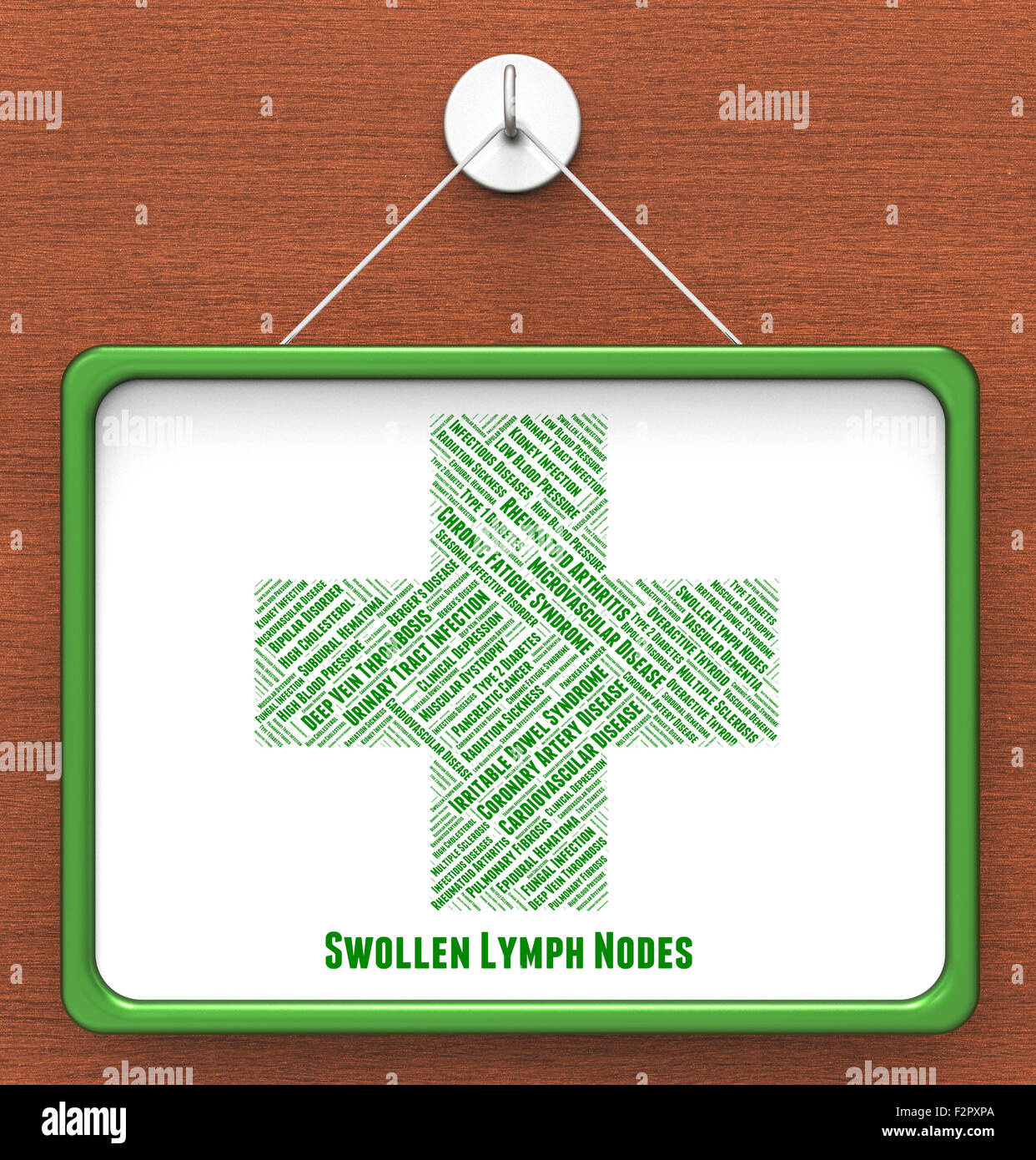 Ganglions enflés lymphangite et Lymphadenitides infectieuses indiquant Photo Stock Alamy