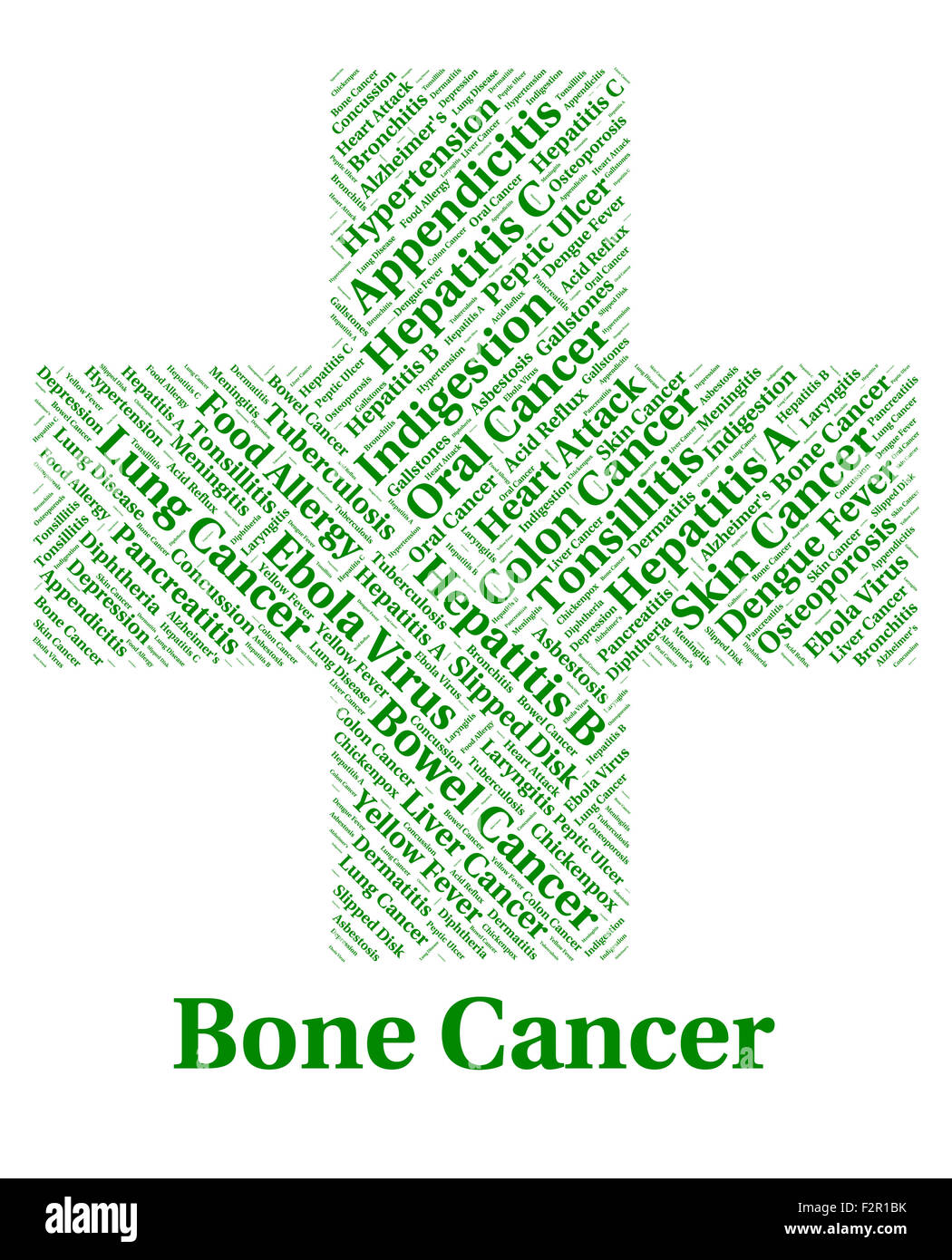 Le cancer des os qui signifie croissance cancéreuse et Maladie Banque D'Images Le cancer des os qui signifie croissance cancéreuse et Maladie Banque D'Images
