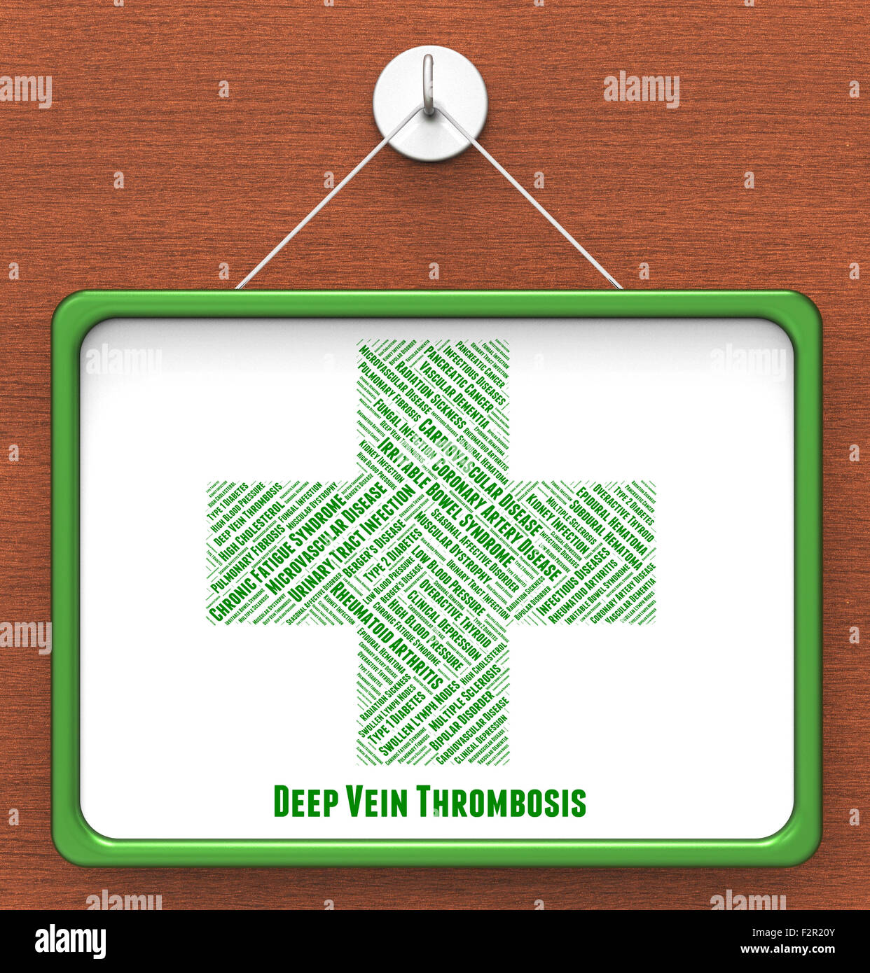 La thrombose profonde de veine montrant des signes de mauvaise santé et de Banque D'Images