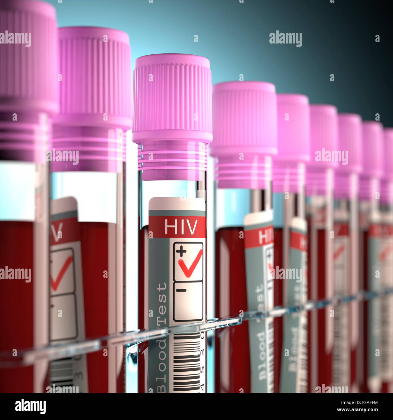 Des échantillons de sang dans des tubes à essai pour le VIH (virus de l'immunodéficience humaine), illustration de l'ordinateur. Banque D'Images