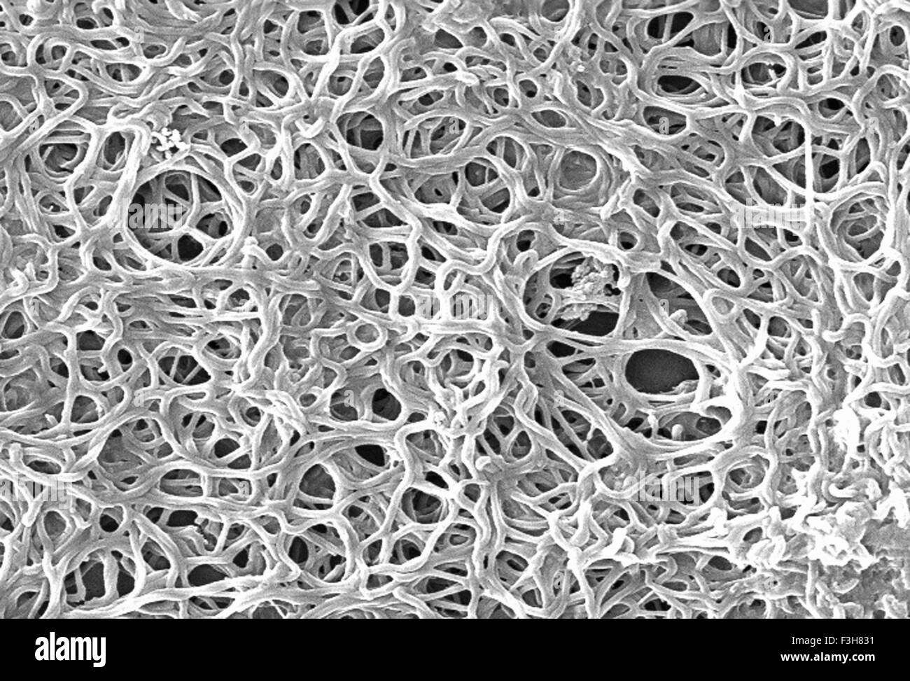 La bactérie Borrelia burgdorferi SEM Banque D'Images