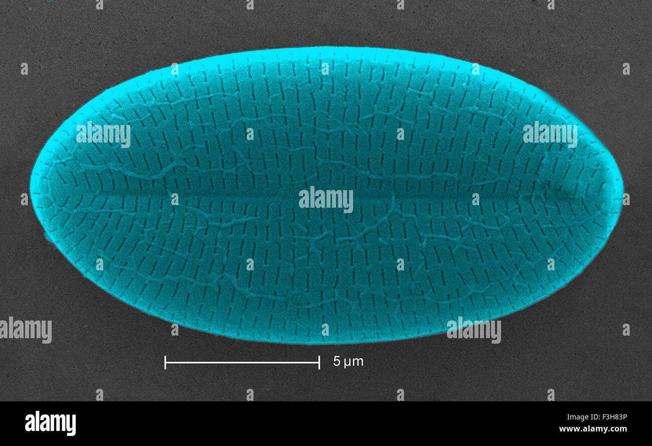 L'analyse des électrons Microphotographie diatomée Banque D'Images