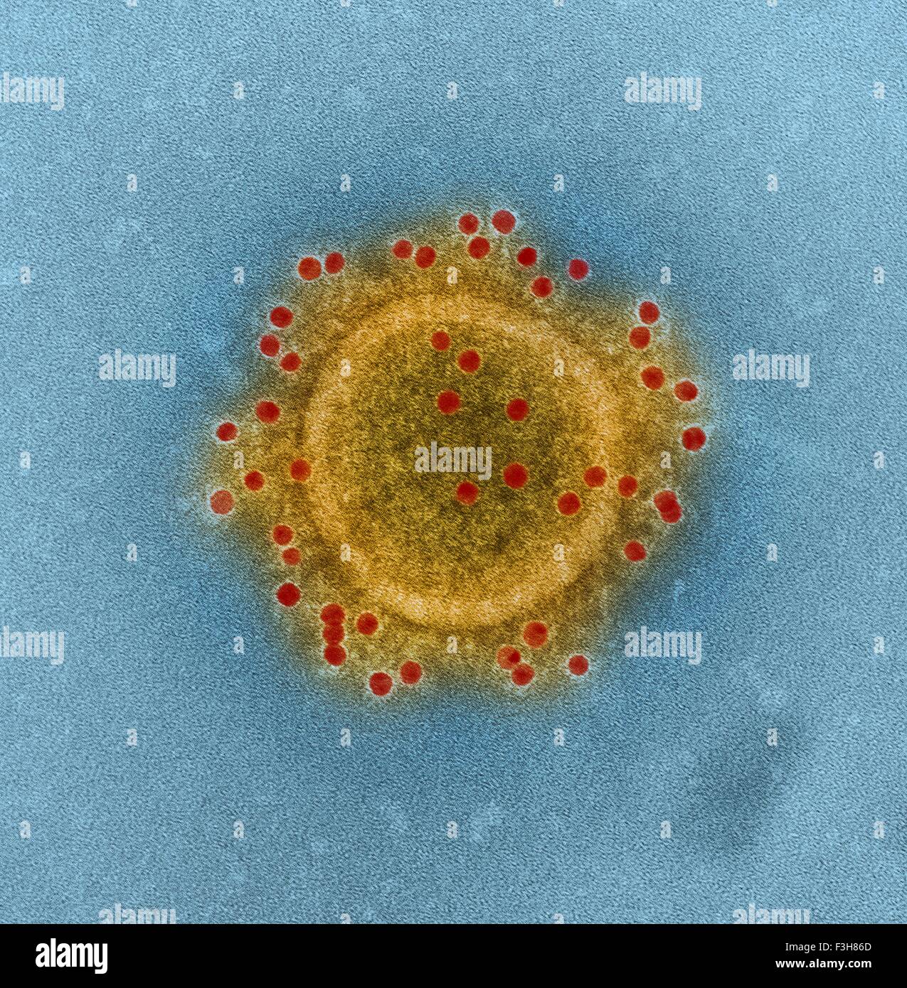 Coronavirus MERS Panneaux de particules - aggloméré Banque D'Images