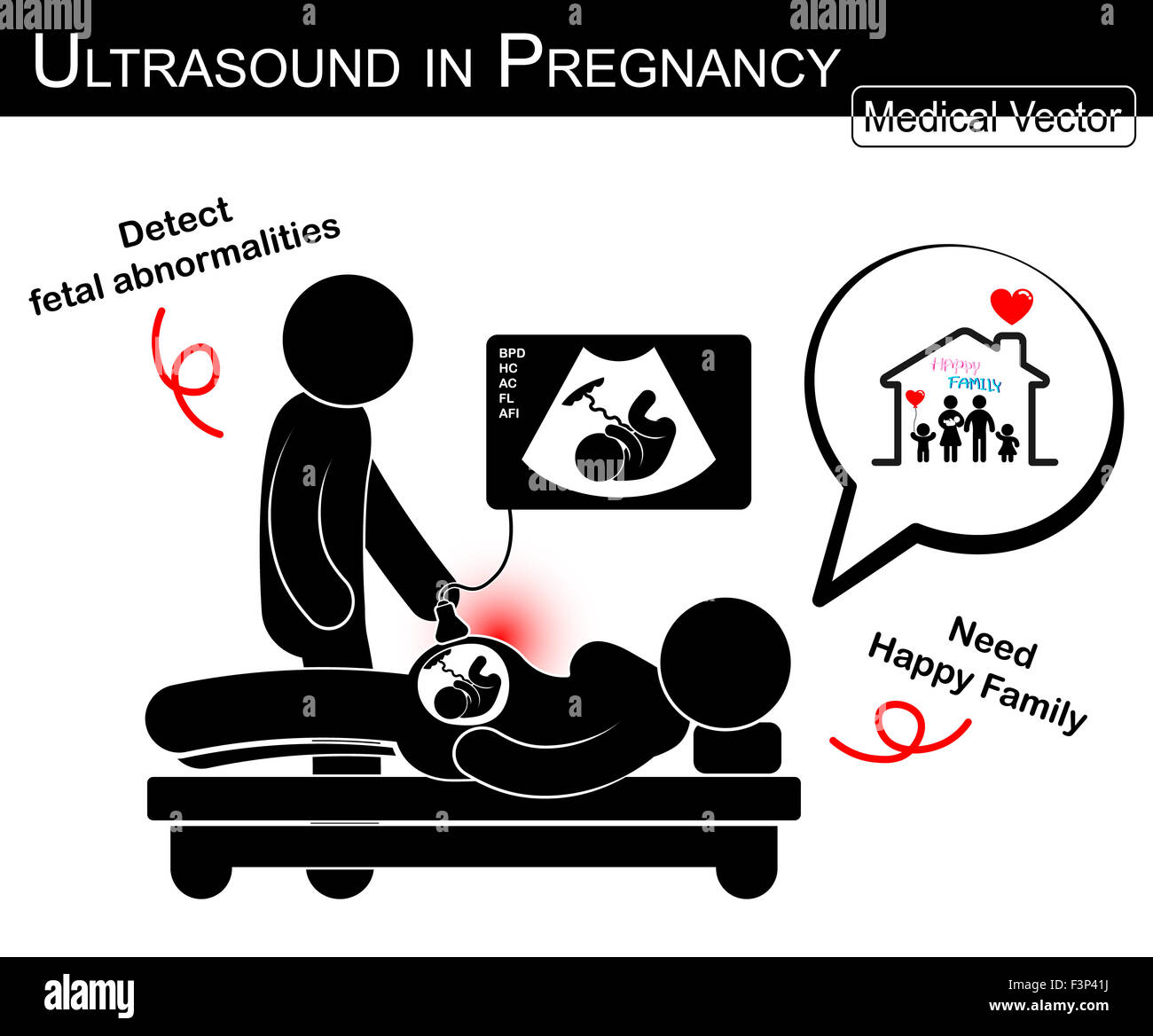 Médecin vérifier jusqu'à la femme enceinte et la croissance du fœtus dans l'utérus par échographie ( femme pensez à une famille heureuse à l'avenir )( Medic Banque D'Images