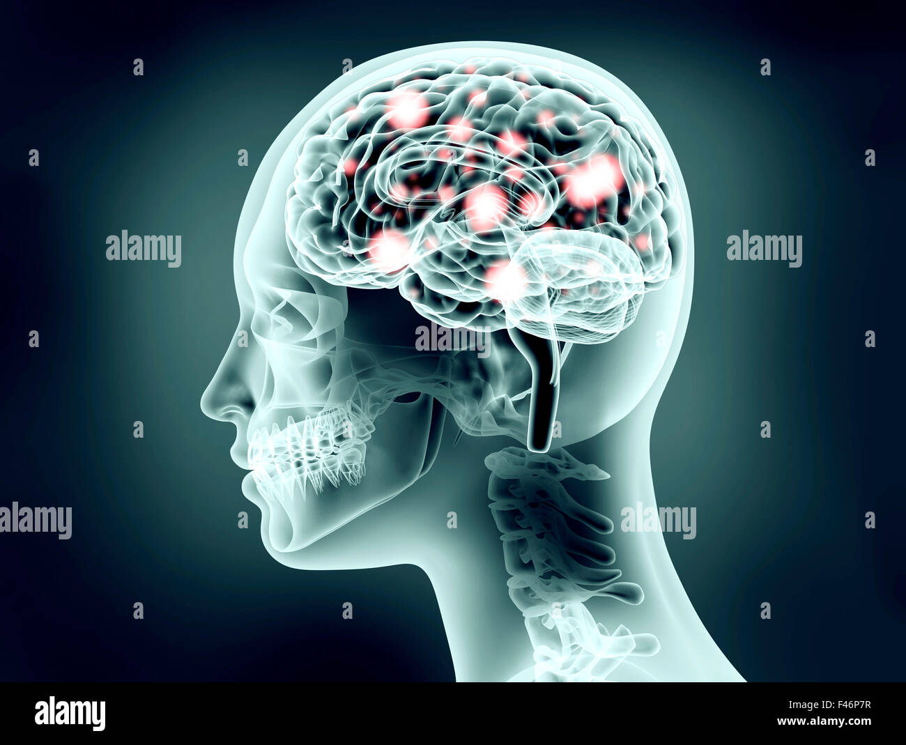 X-ray image de tête humaine avec cerveau et impulsions électriques Banque D'Images